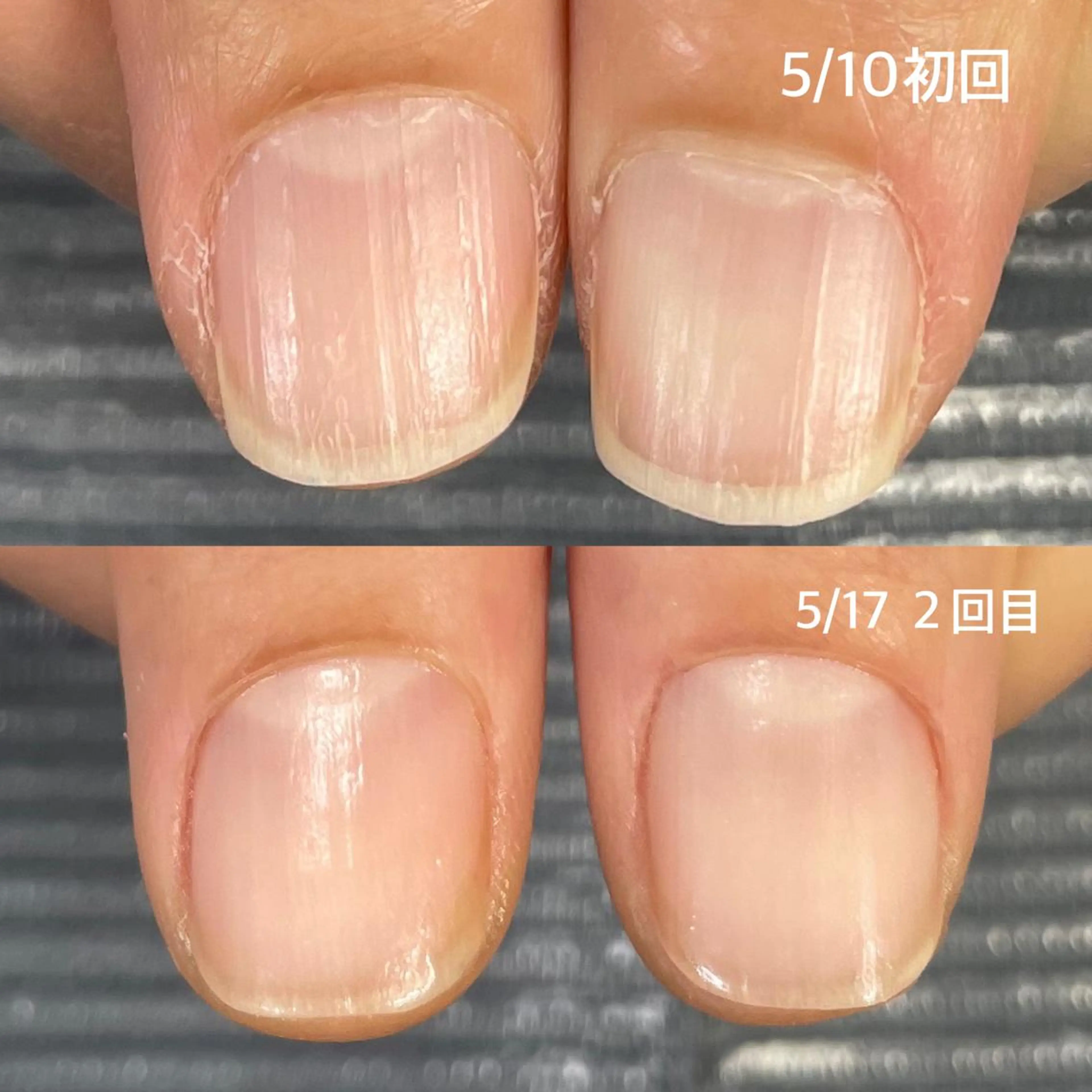 ネイル 奥園 良恵のネイルデザイン