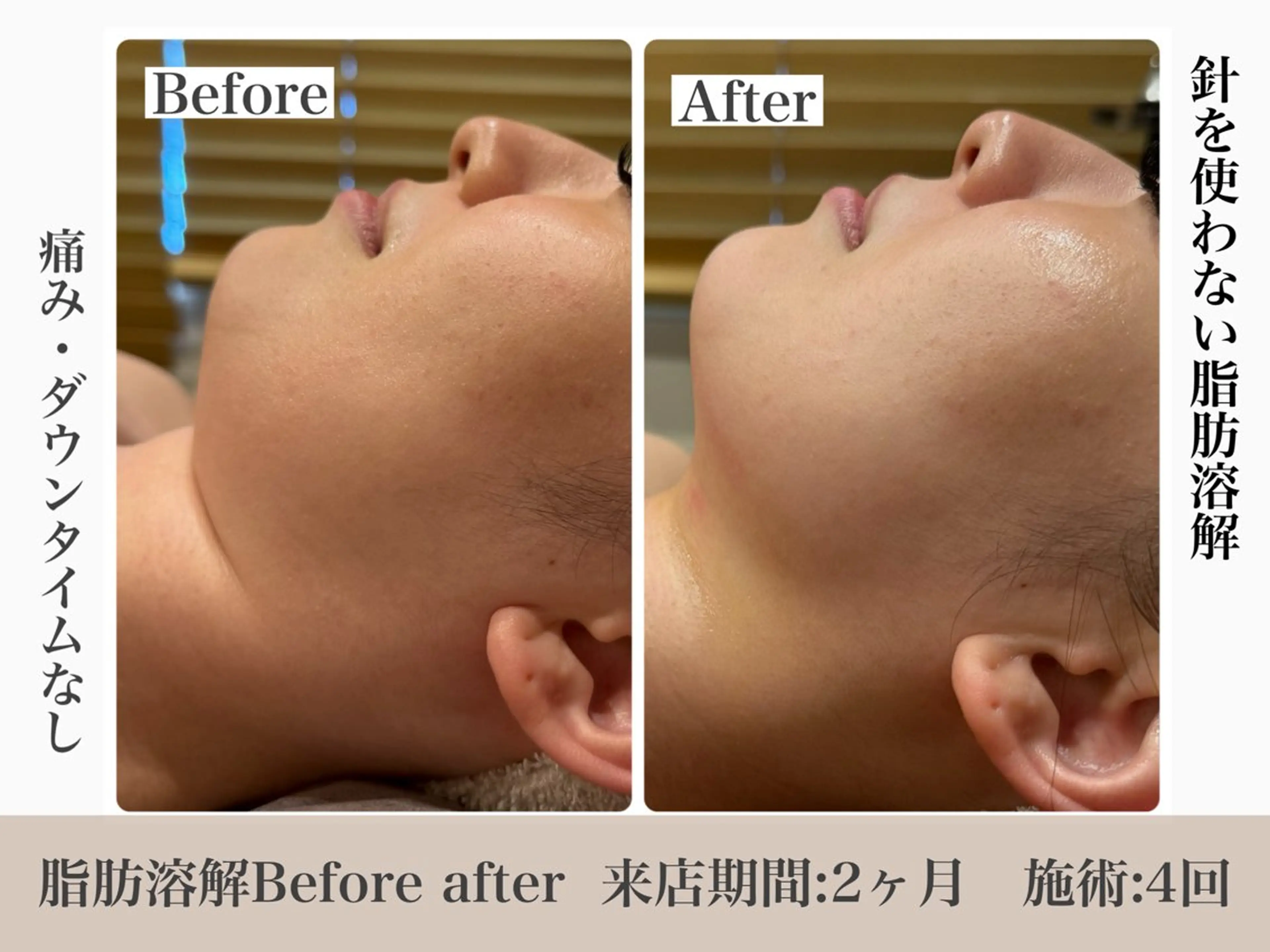 脱毛&フェイシャル 専門店muro.のエステ・リラクイメージ