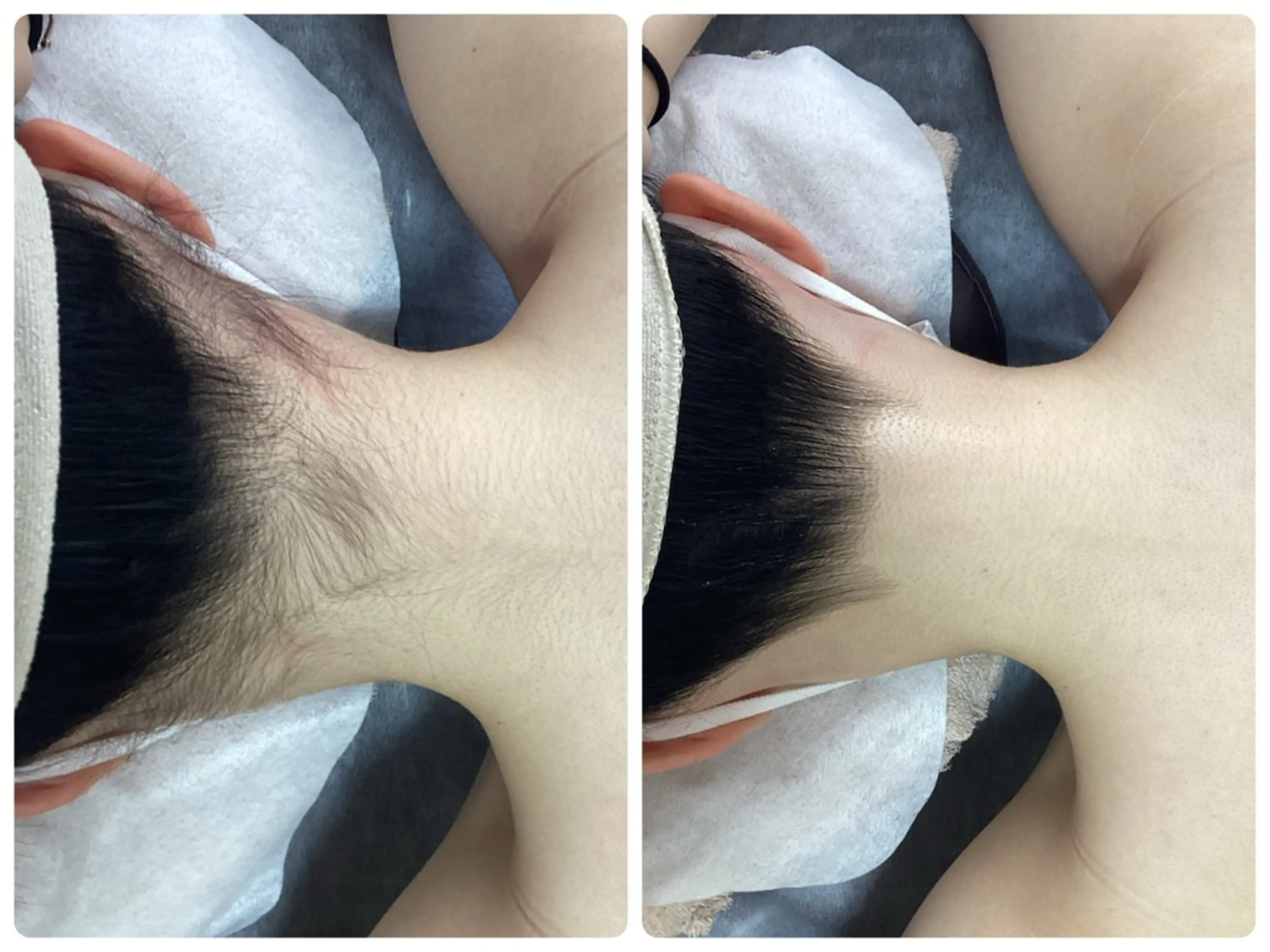 脱毛 脱毛専門減毛サロン LULU.tokyoのエステ・リラクイメージ