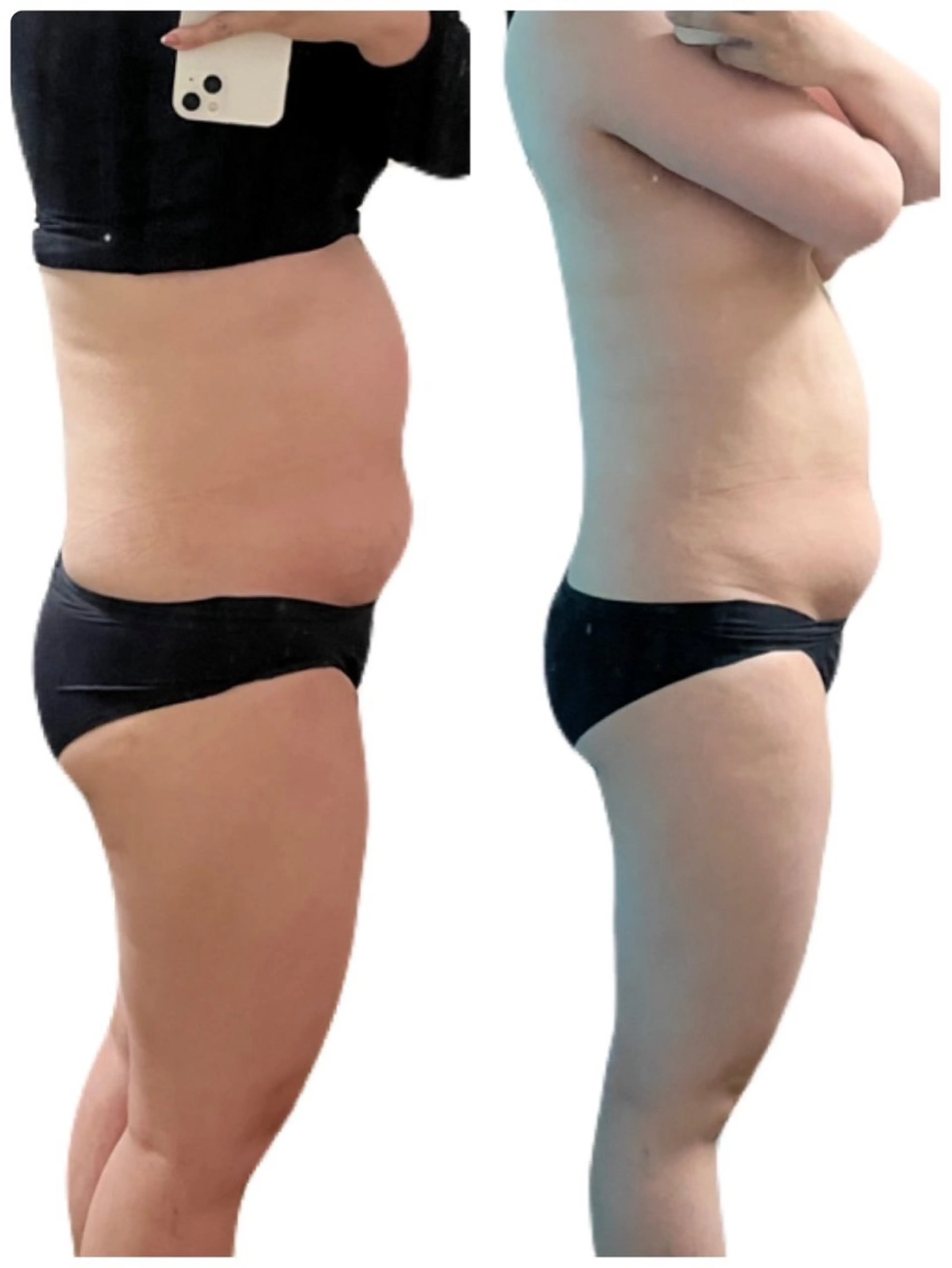 エステ リラク 痩身サロン ベルタ 薬院店 濵畑のエステ・リラクイメージ