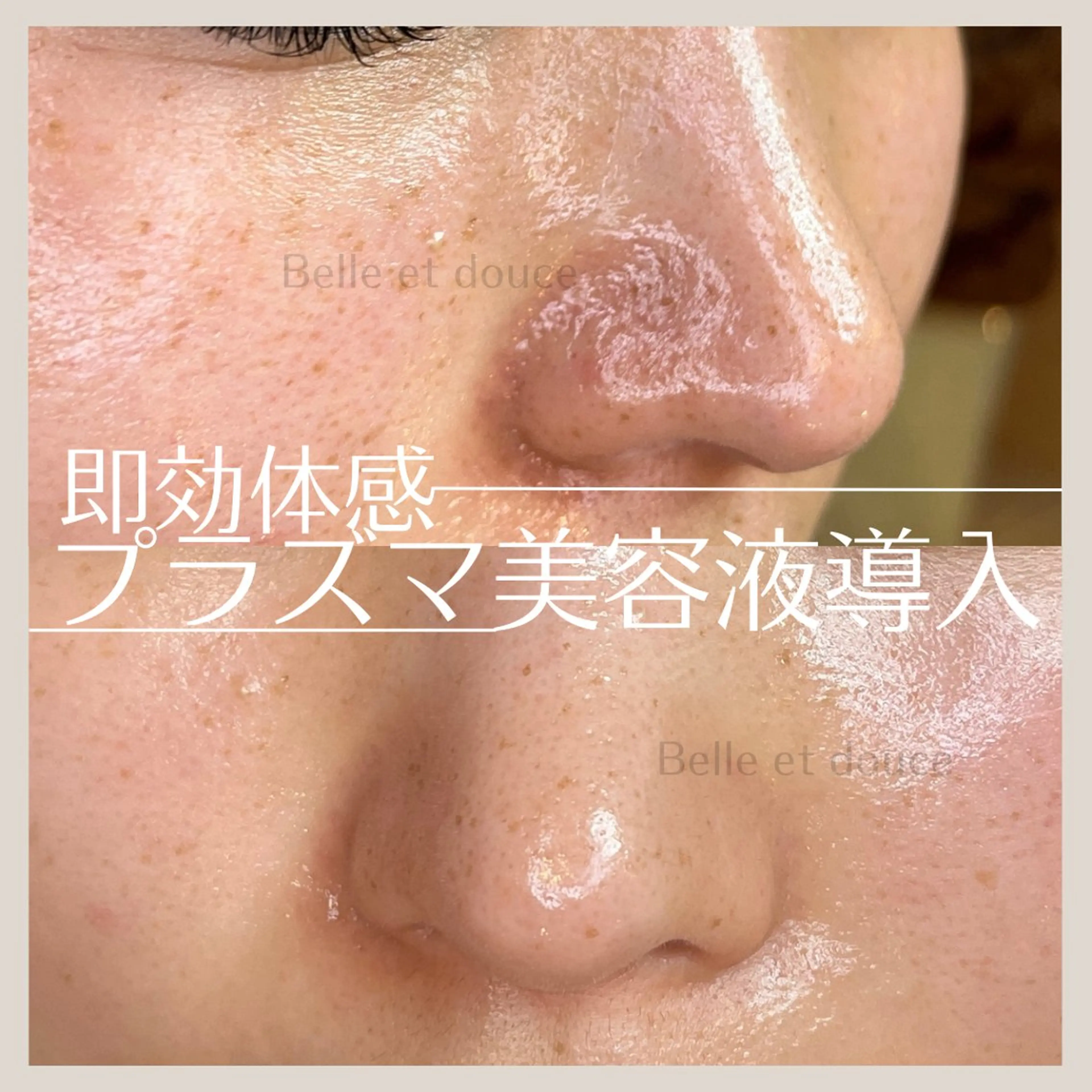 エステ Belle et douce所属・毛穴ケア専門サロン ベルエドゥースのエステ・リラクイメージ