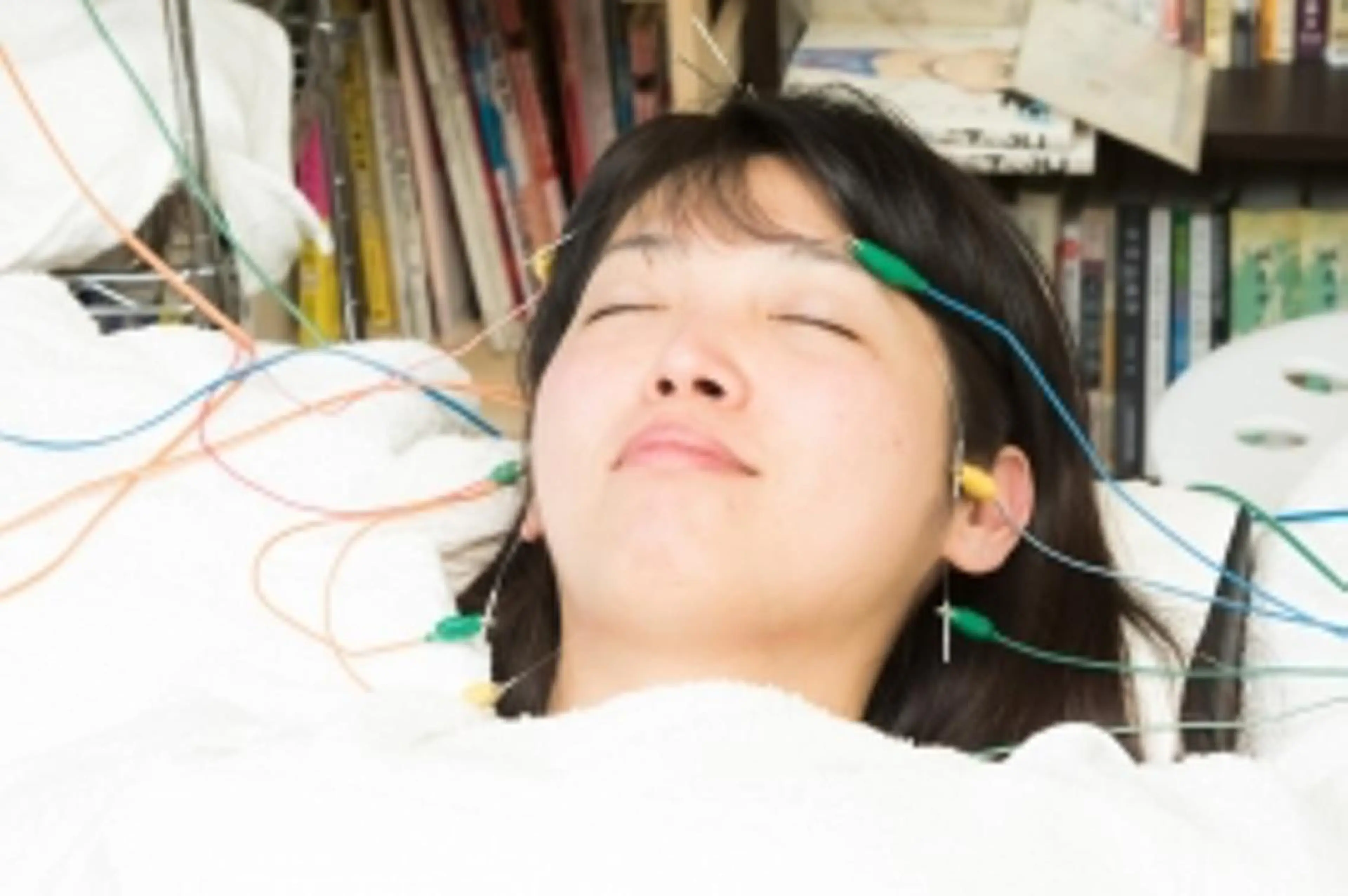 【プレミアム】biribiri美容鍼の写真