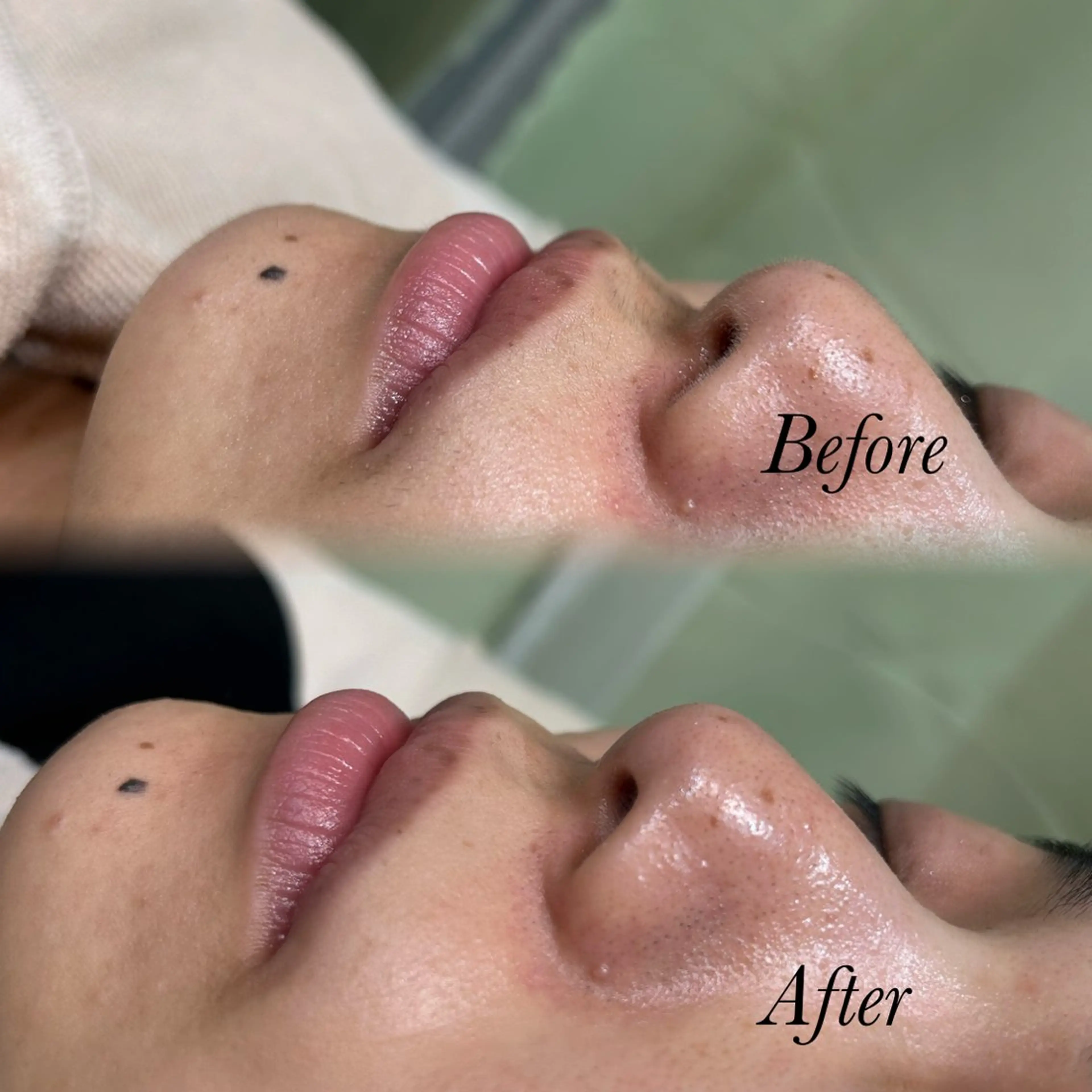 その他 🫧美しい素肌へ🫧 今成柚乃のその他イメージ