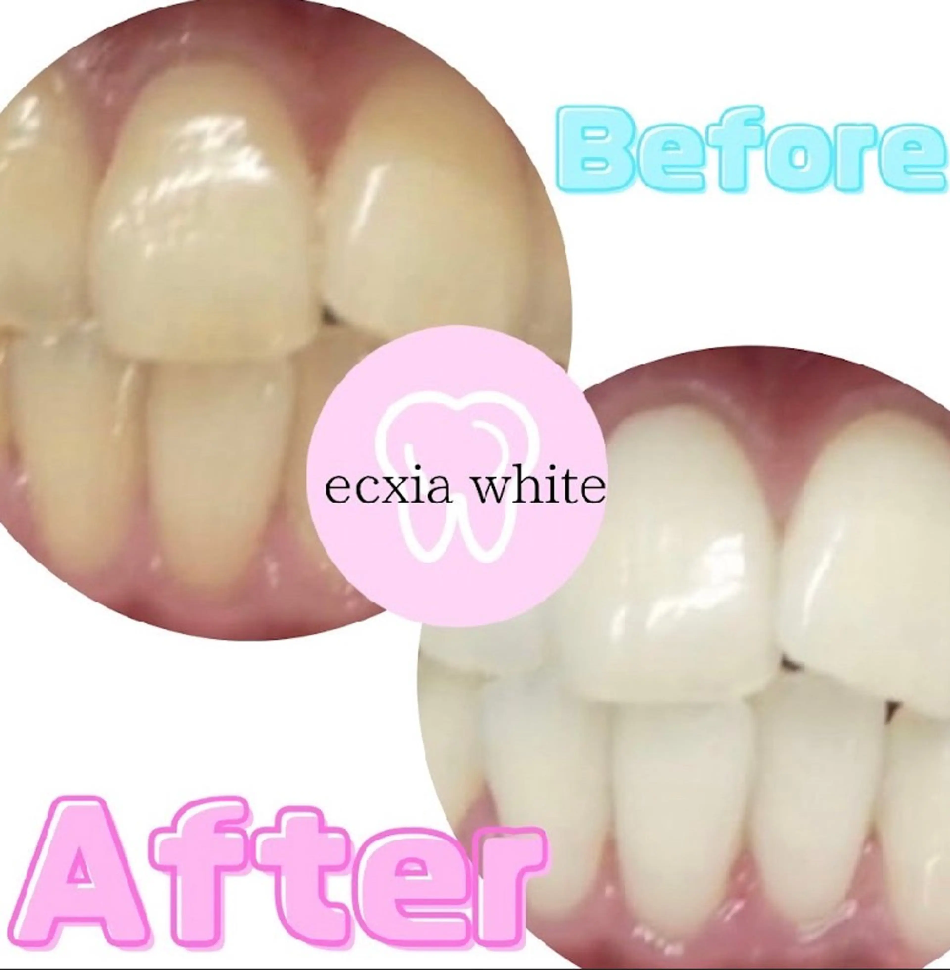 メンズ その他 エクシアホワイトニング草津店所属・nanami -ホワイトニングのその他イメージ