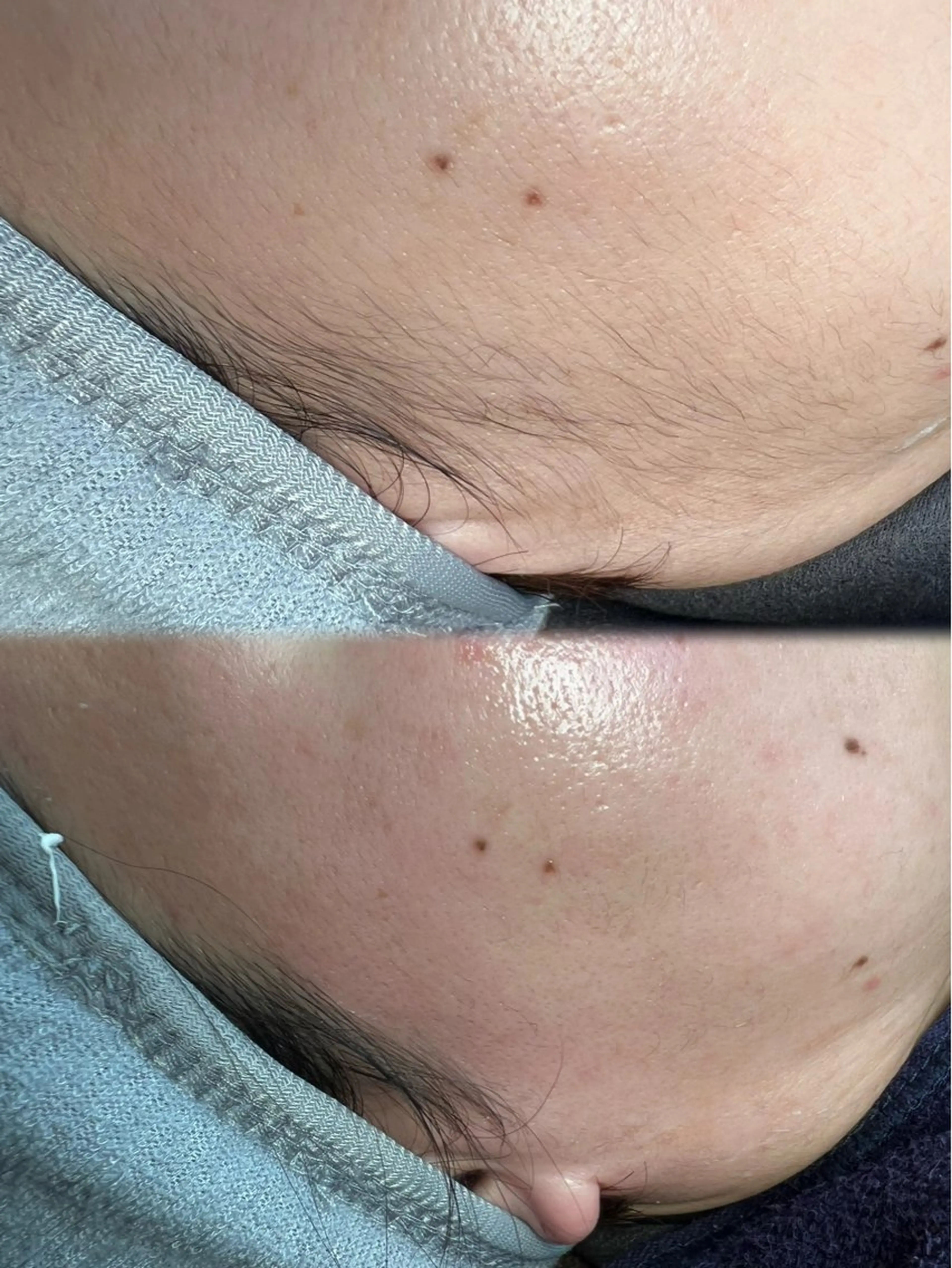 Nalu所属・まつ毛パーマ／脱毛 Naluのエステ・リラクイメージ