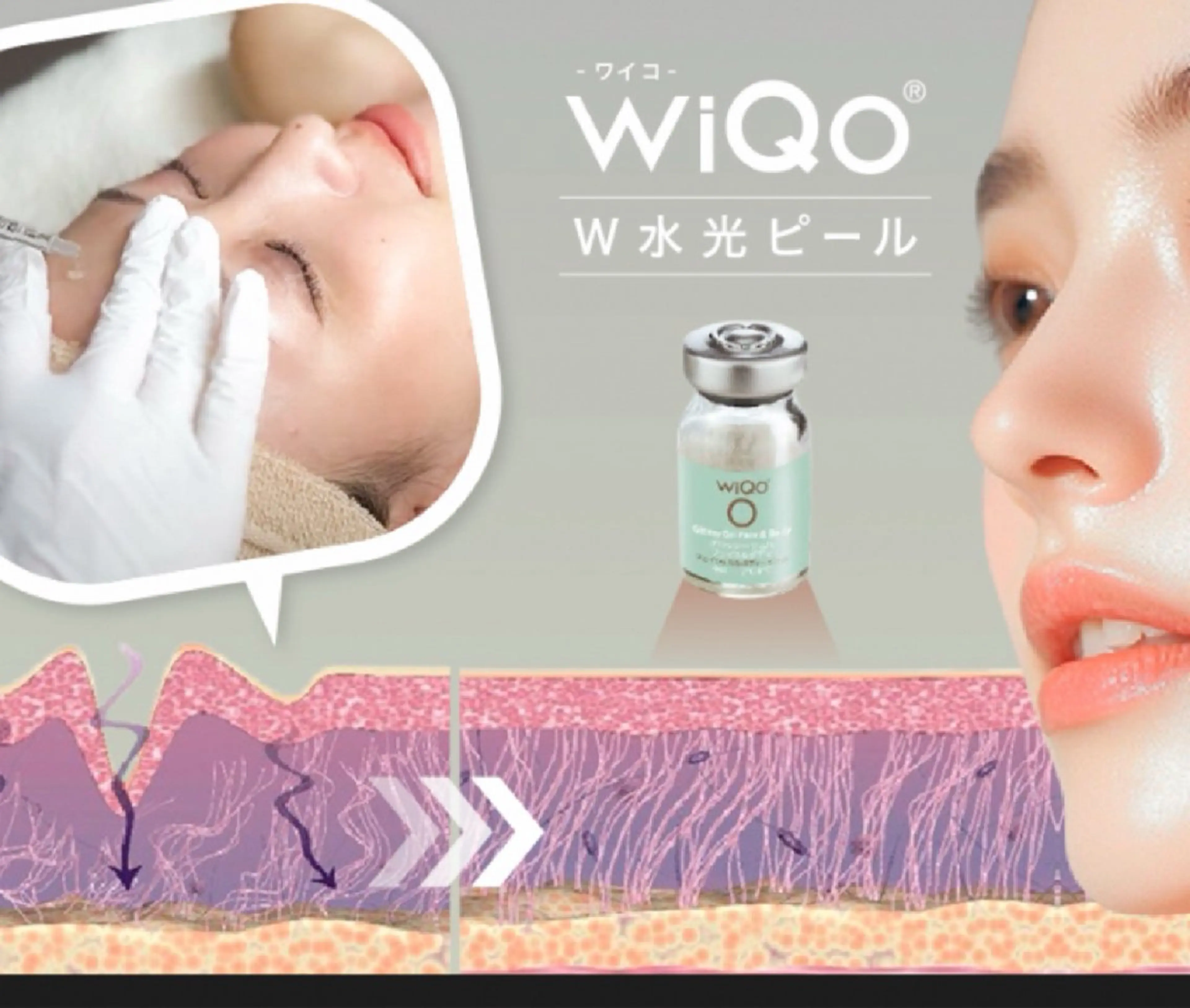 【1番人気】黒ずみ毛穴洗浄×WiQo水光ピール×全顔導入付きの写真