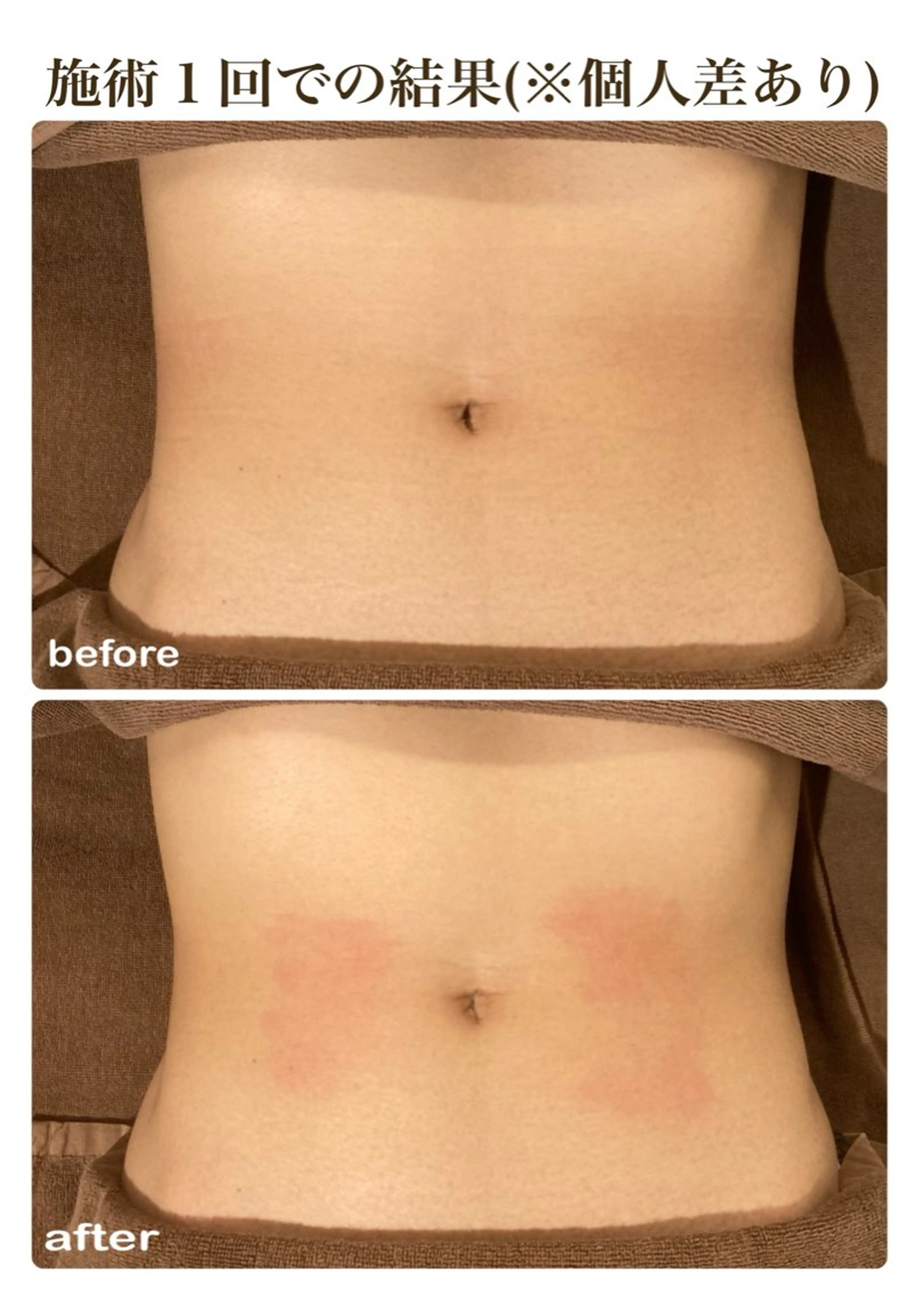 Refull（リフル）所属・Refull （リフル）のエステ・リラクイメージ