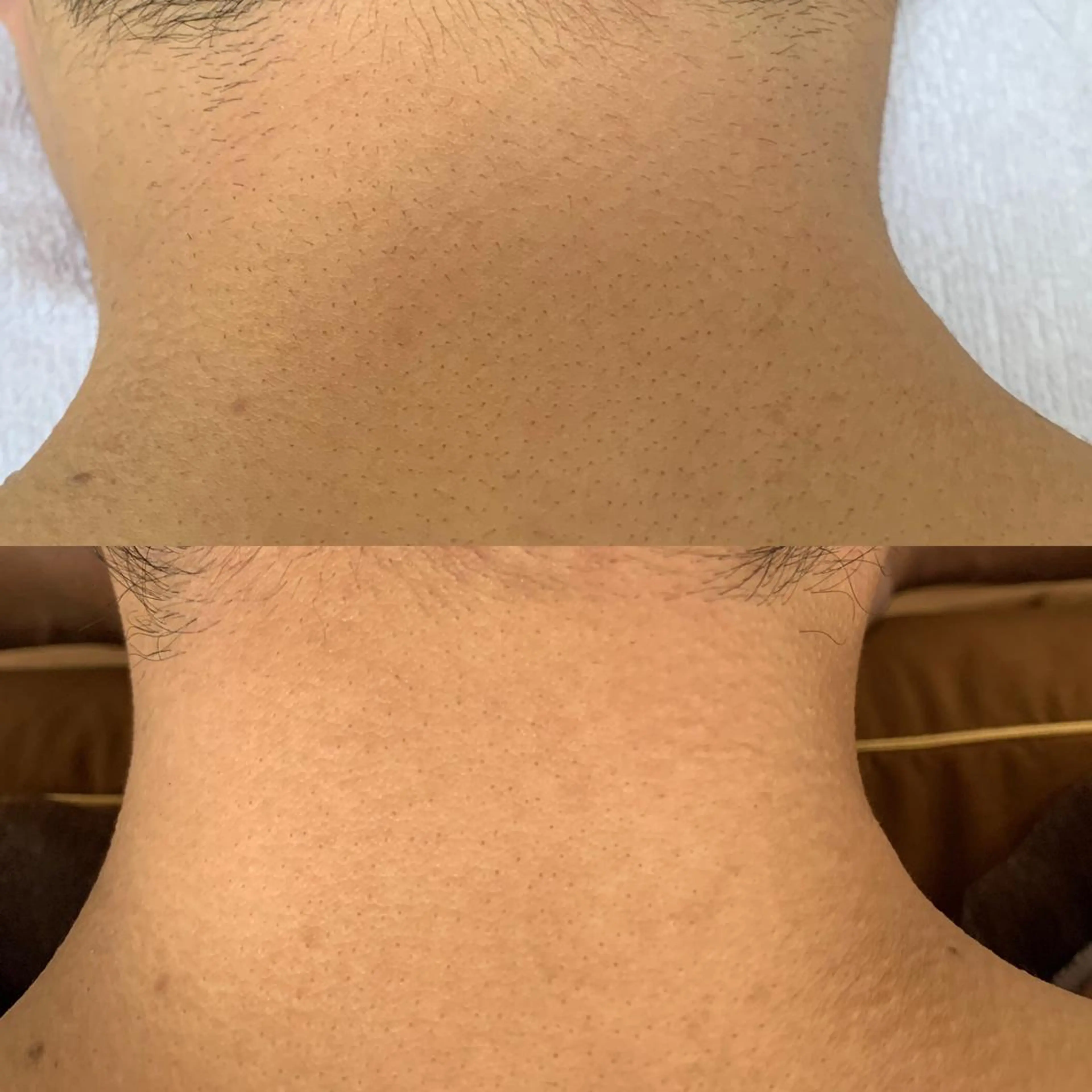 メンズ キッズ 脱毛SALON RaYNiCKのエステ・リラクイメージ