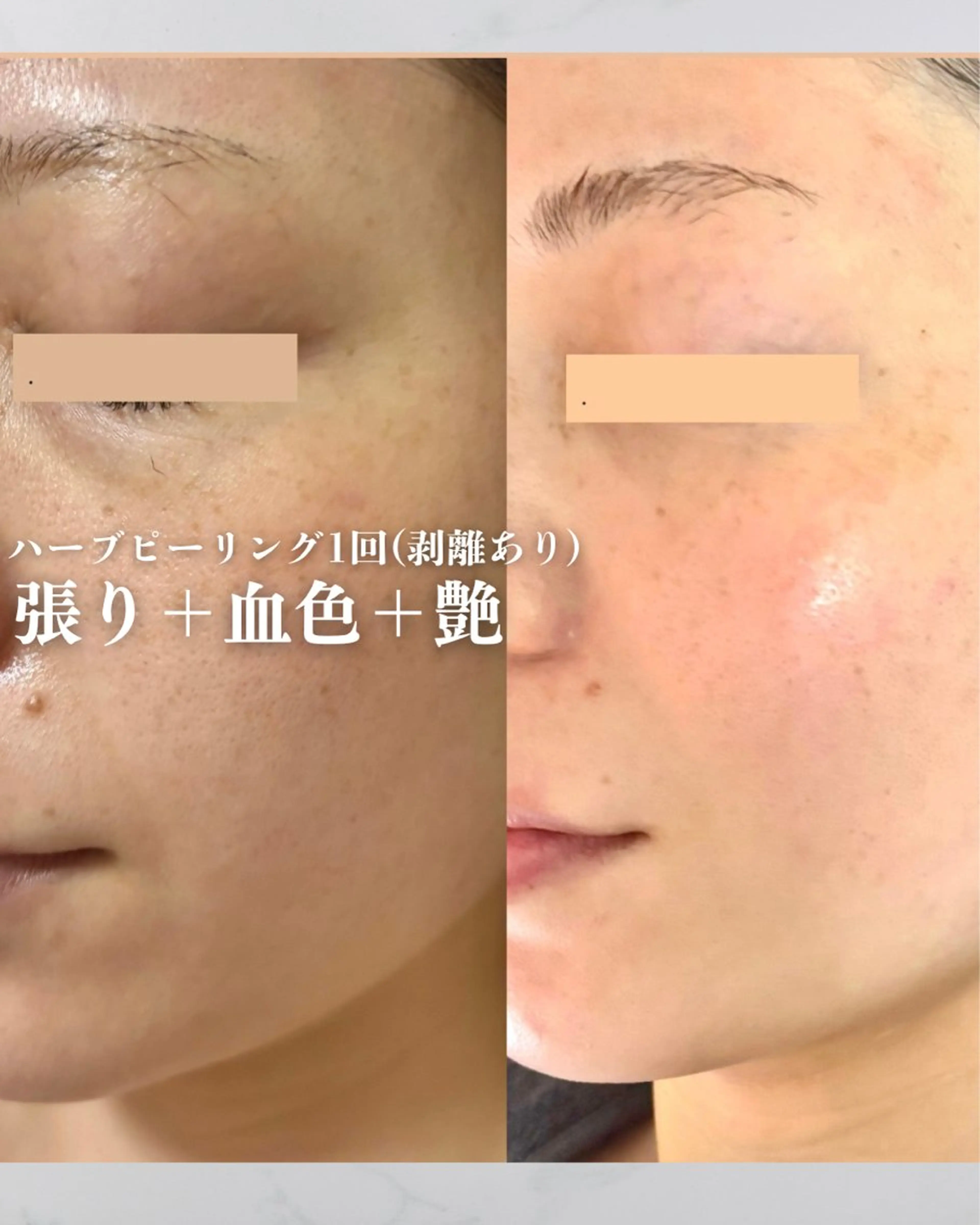 カムイ所属・カムイ 山﨑のエステ・リラクイメージ