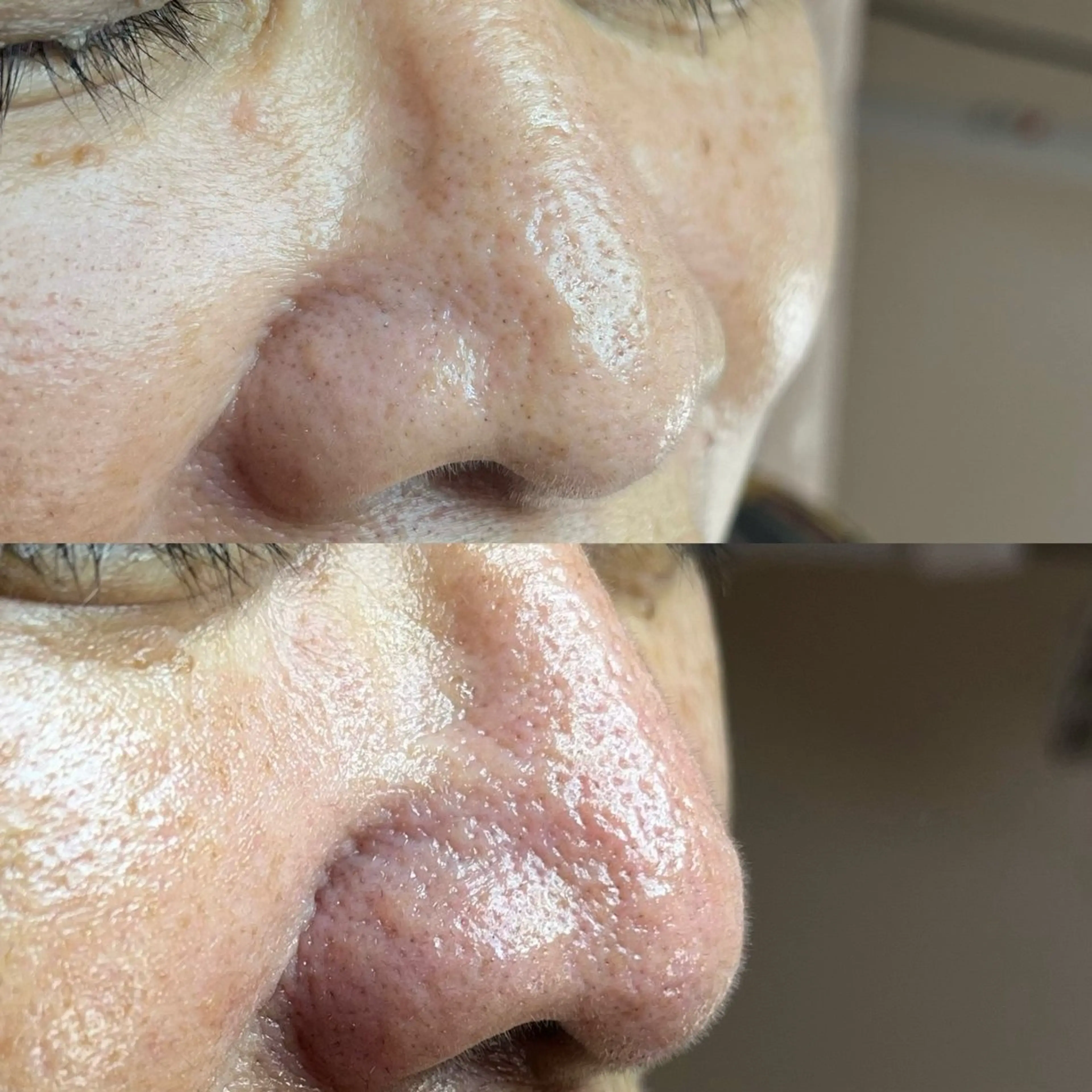 毛穴ケア・ヘッドスパサロンSHINY(シャイニー)所属・毛穴ケア・ヘッドスパ サロンSHINYのエステ・リラクイメージ