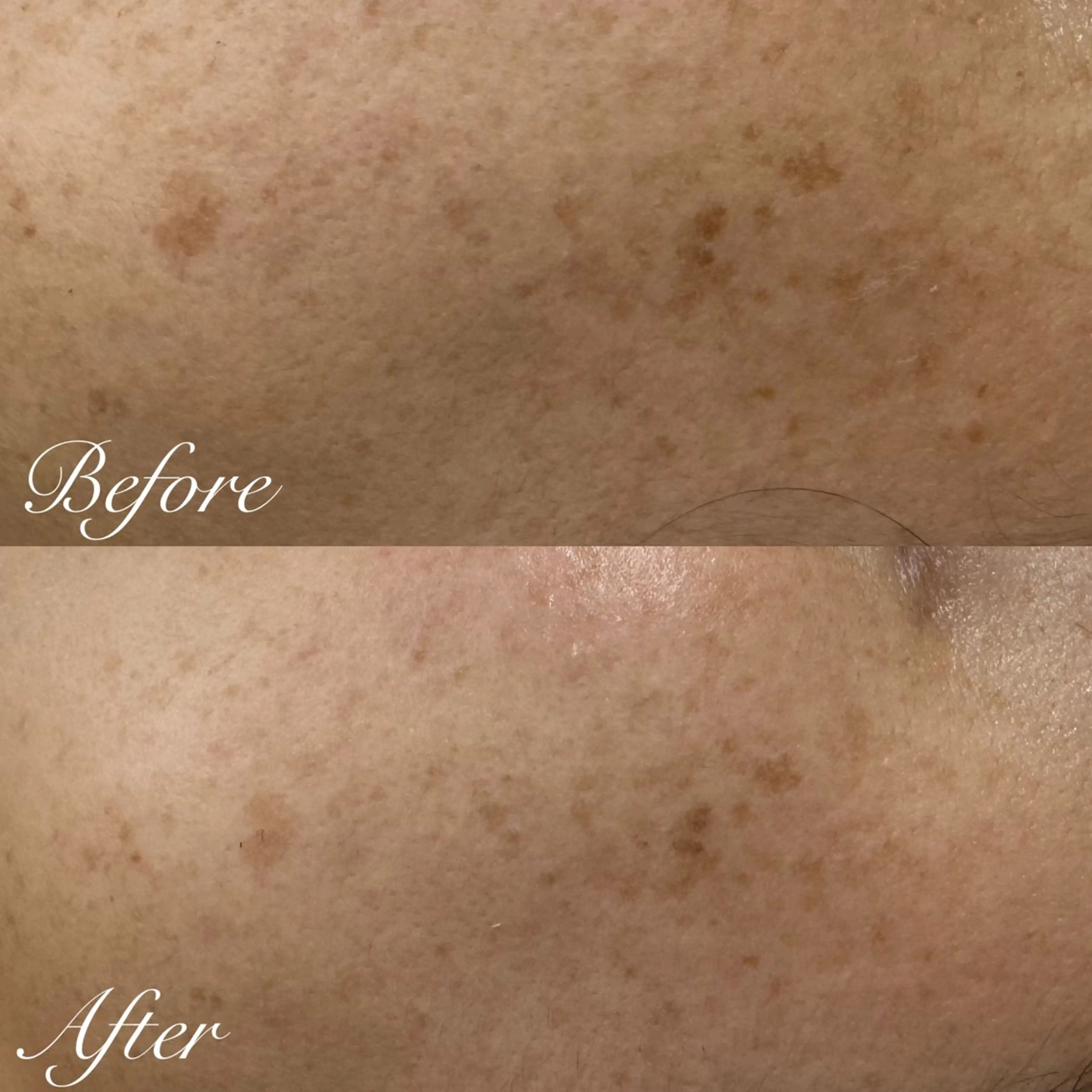 エステ シミ🩷ニキビ専門店 Matteo🎀✨のエステ・リラクイメージ