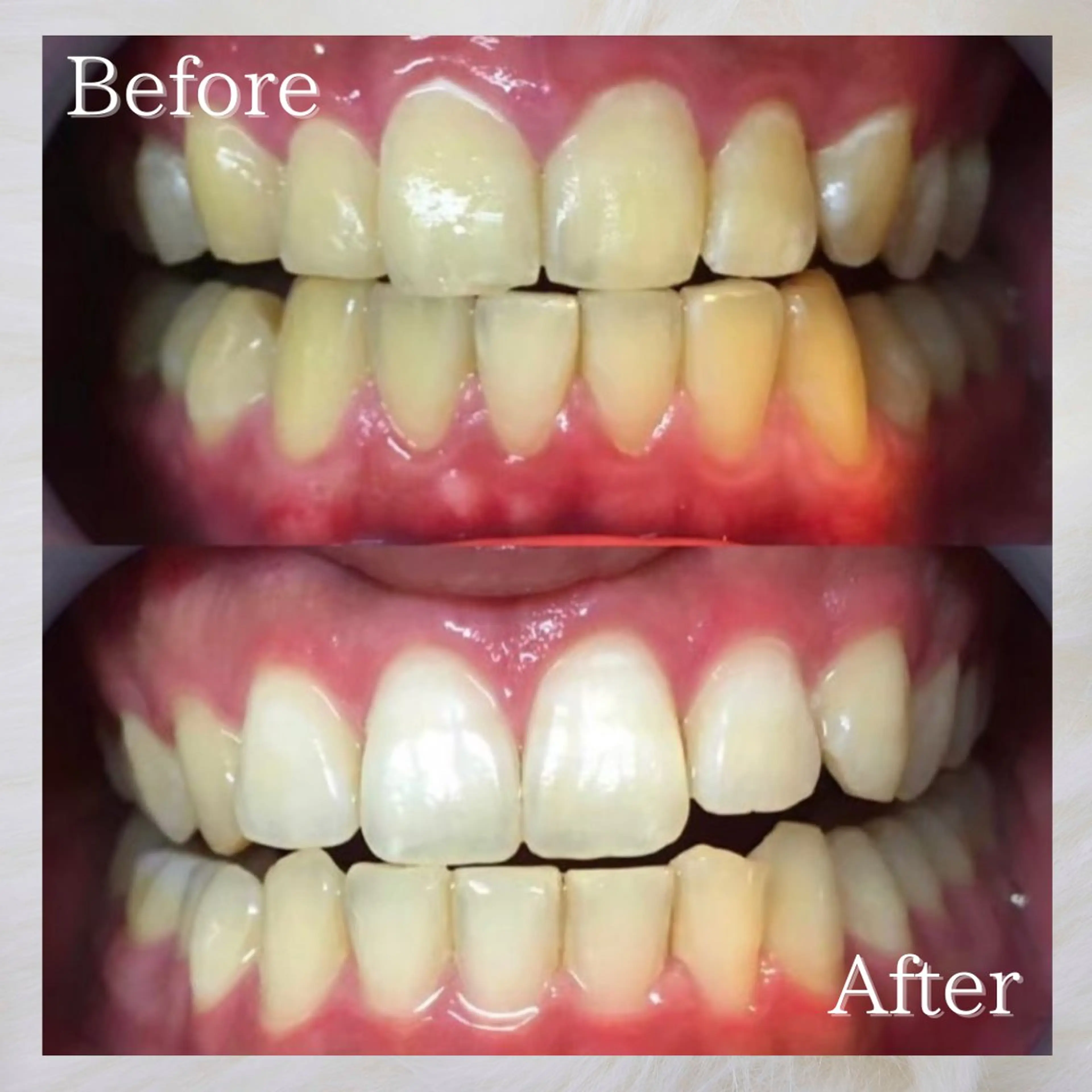 LBSホワイトニング 🌐岡山店のその他イメージ