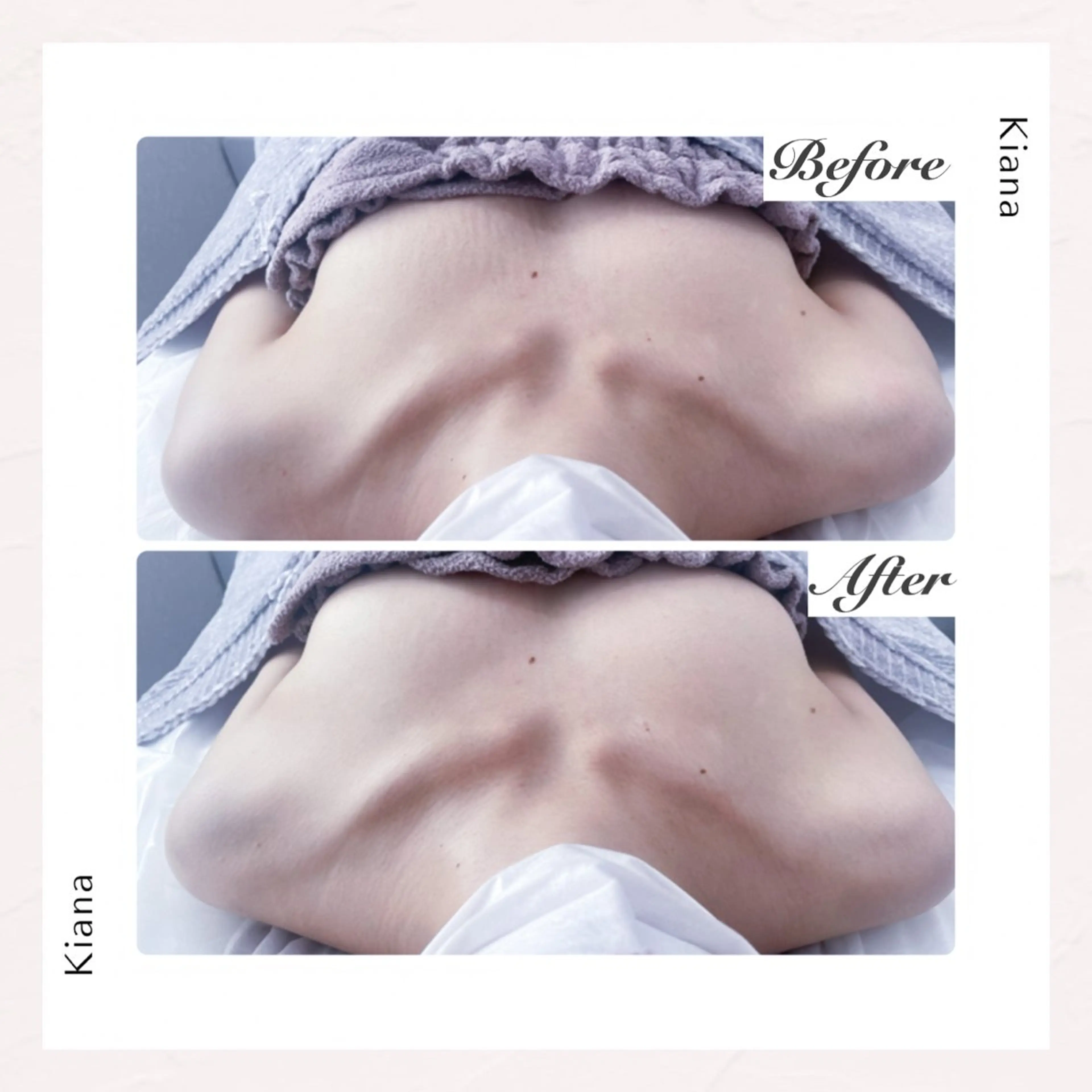 エステ リラク バスト専門Kiana 風のエステ・リラクイメージ