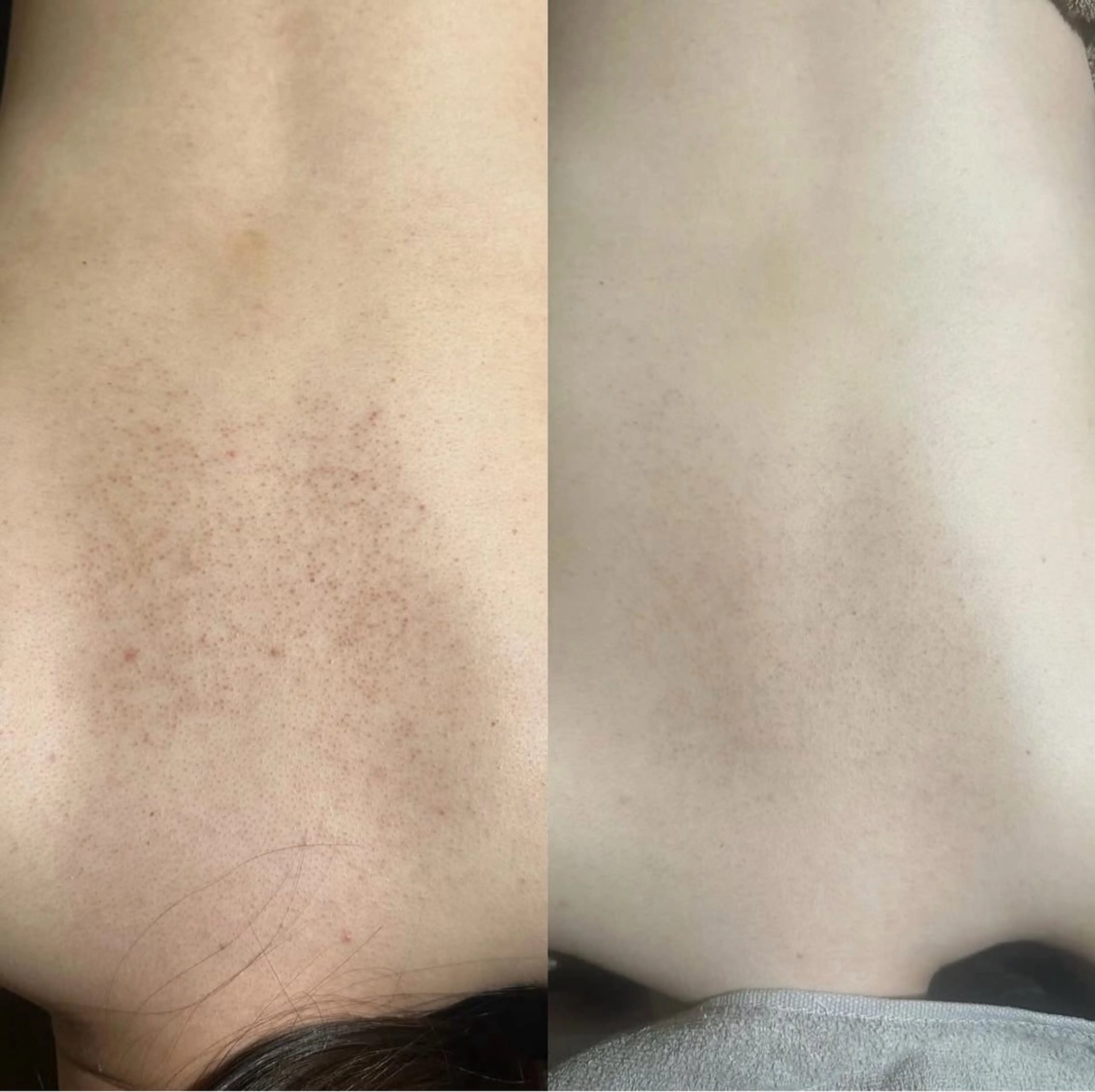 エミルカ　自由が丘店所属・花島 悠のエステ・リラクイメージ