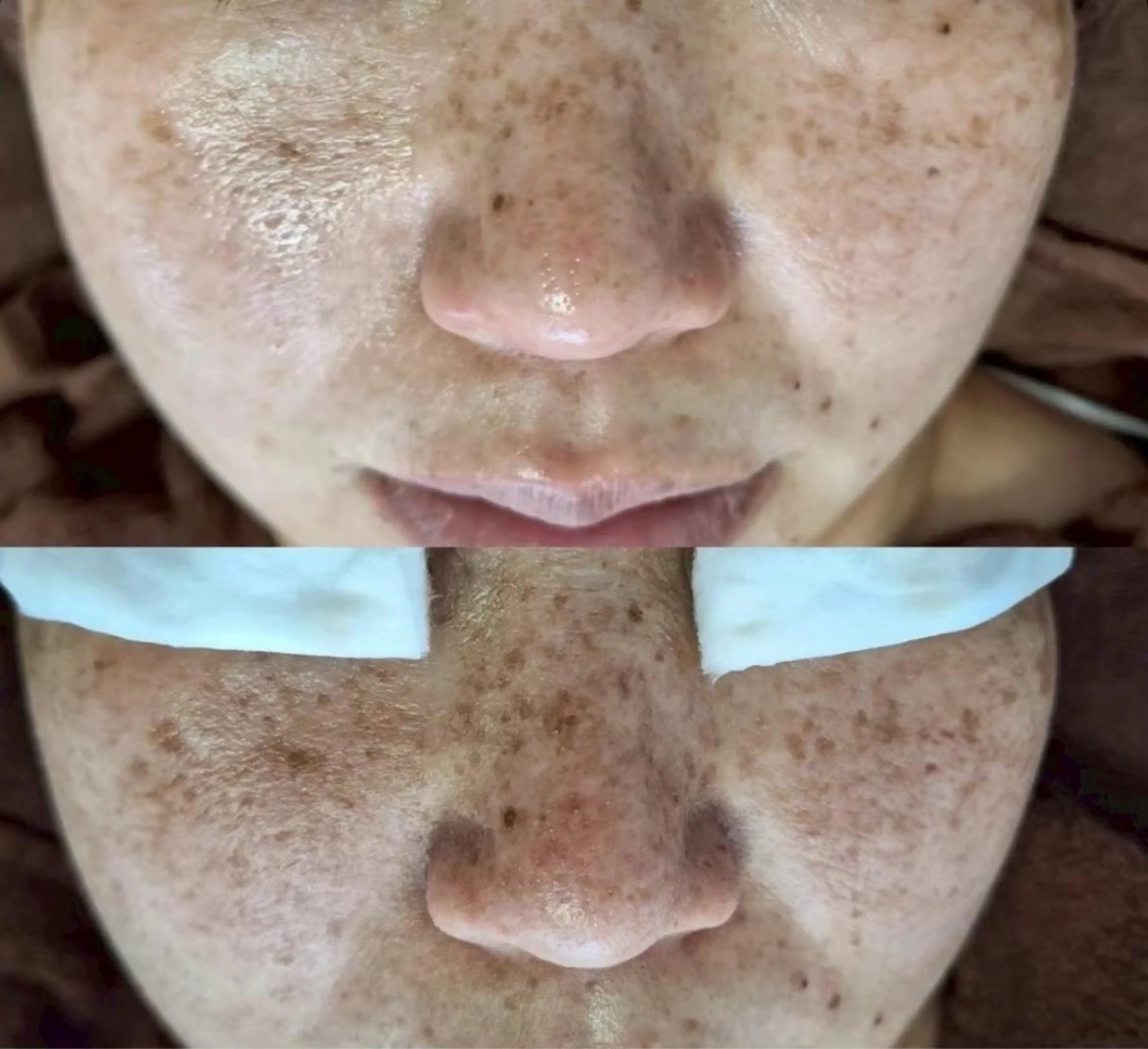 エルモサ痩身脱毛　西八王子店所属・エルモサ痩身脱毛 西八王子店のエステ・リラクイメージ