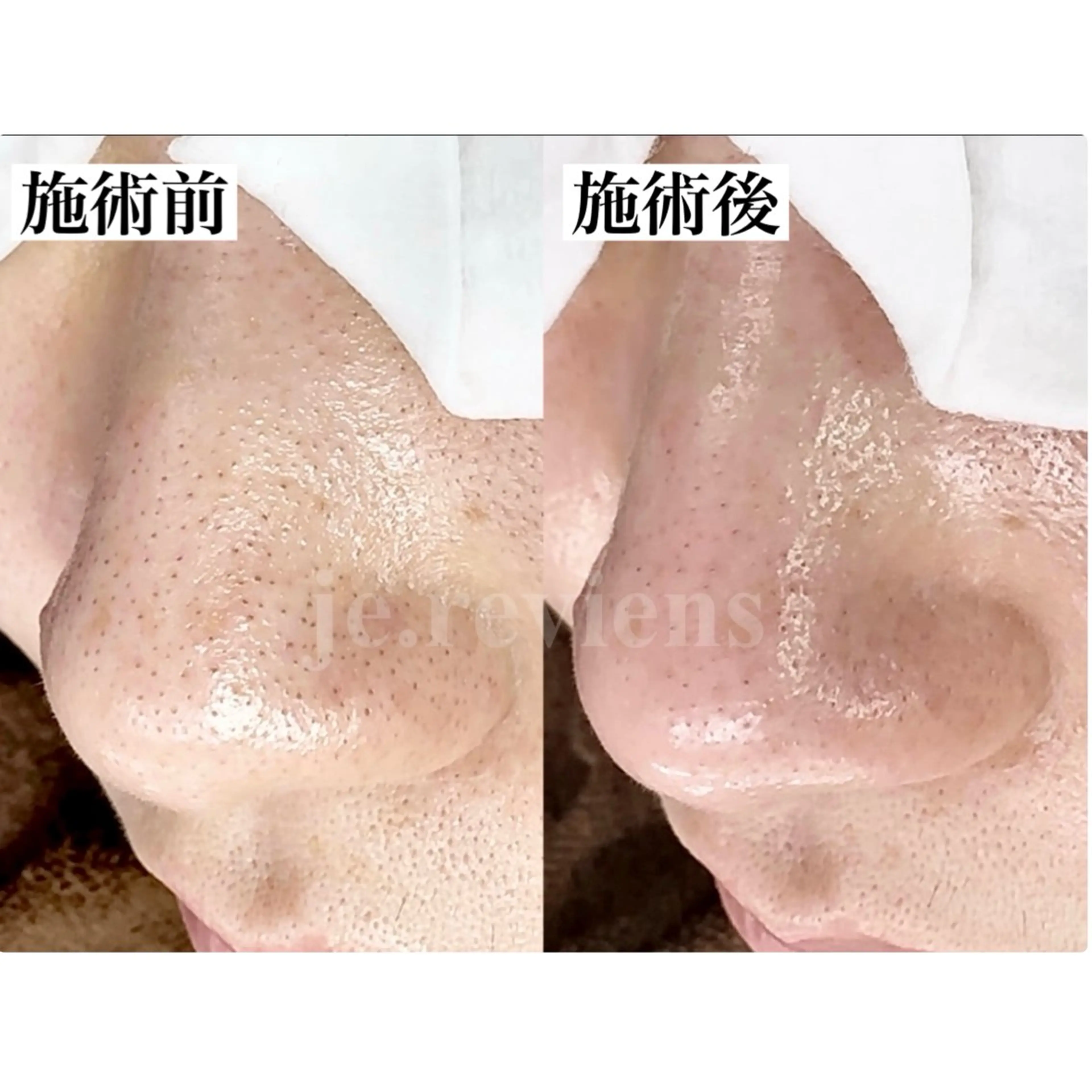 ジュルビアン美容室所属・ジュルビアン 美容室のエステ・リラクイメージ