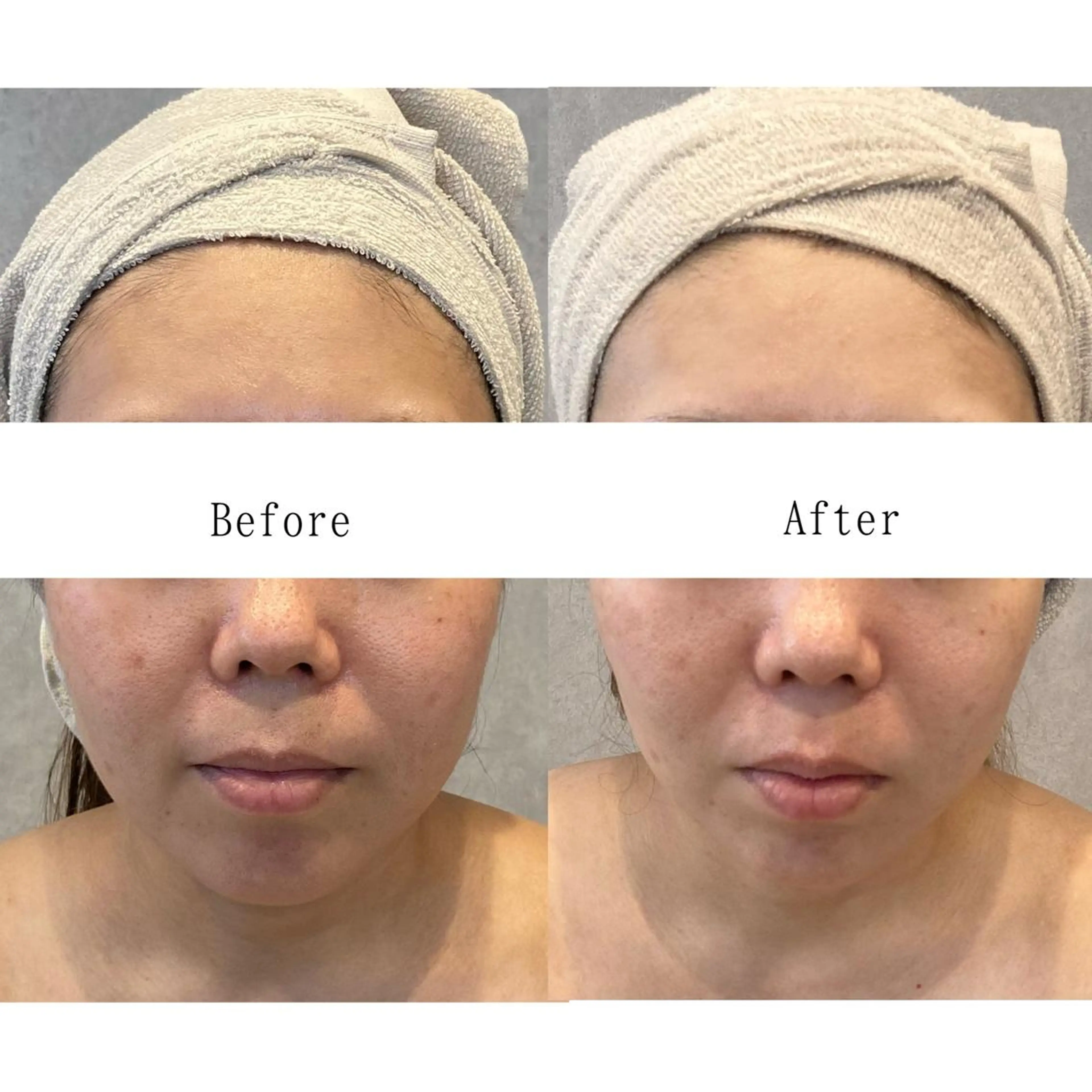 Lavieriche "ラヴィリッシュ"のエステ・リラクイメージ