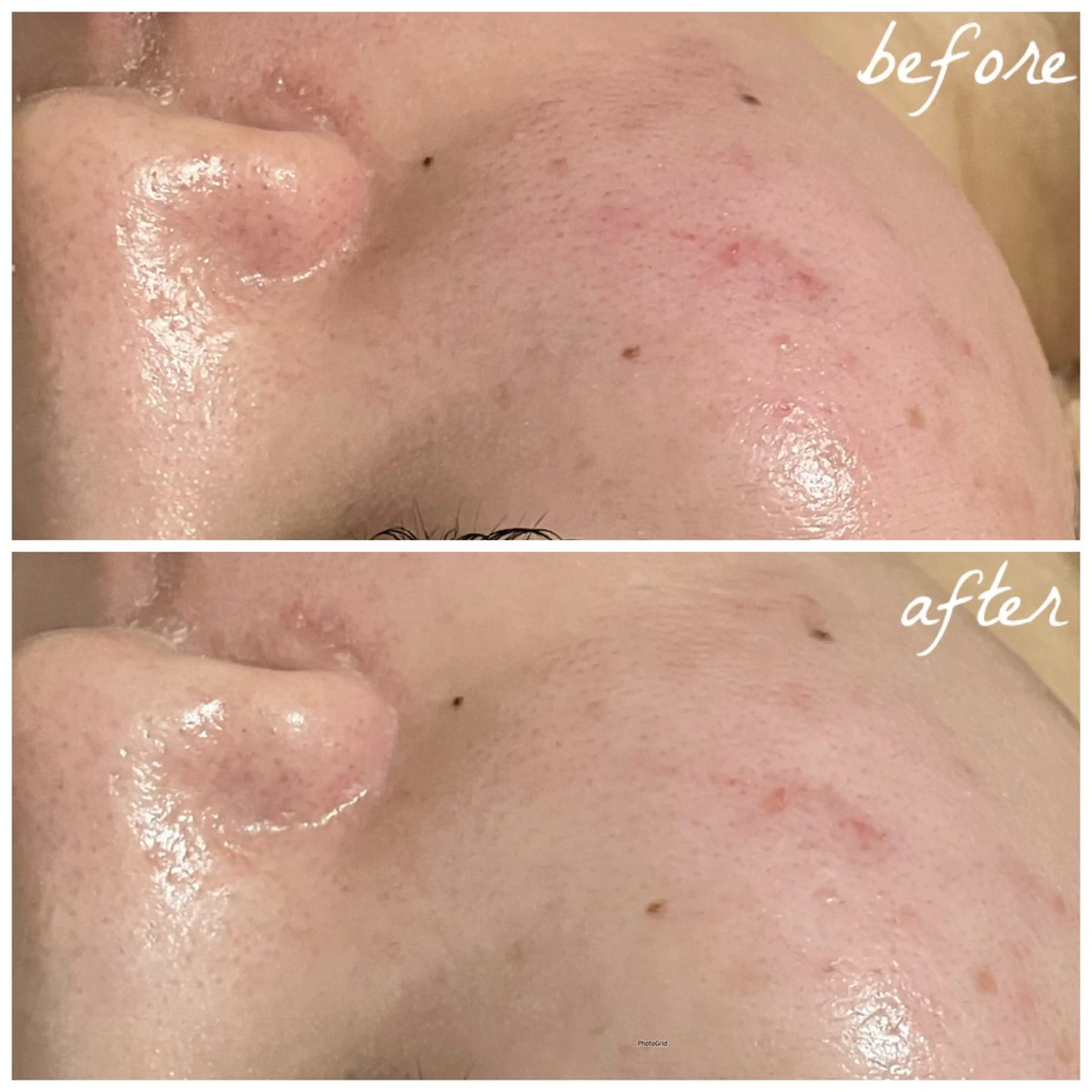 メンズ エステ メナード岐阜茜部 杉浦のエステ・リラクイメージ