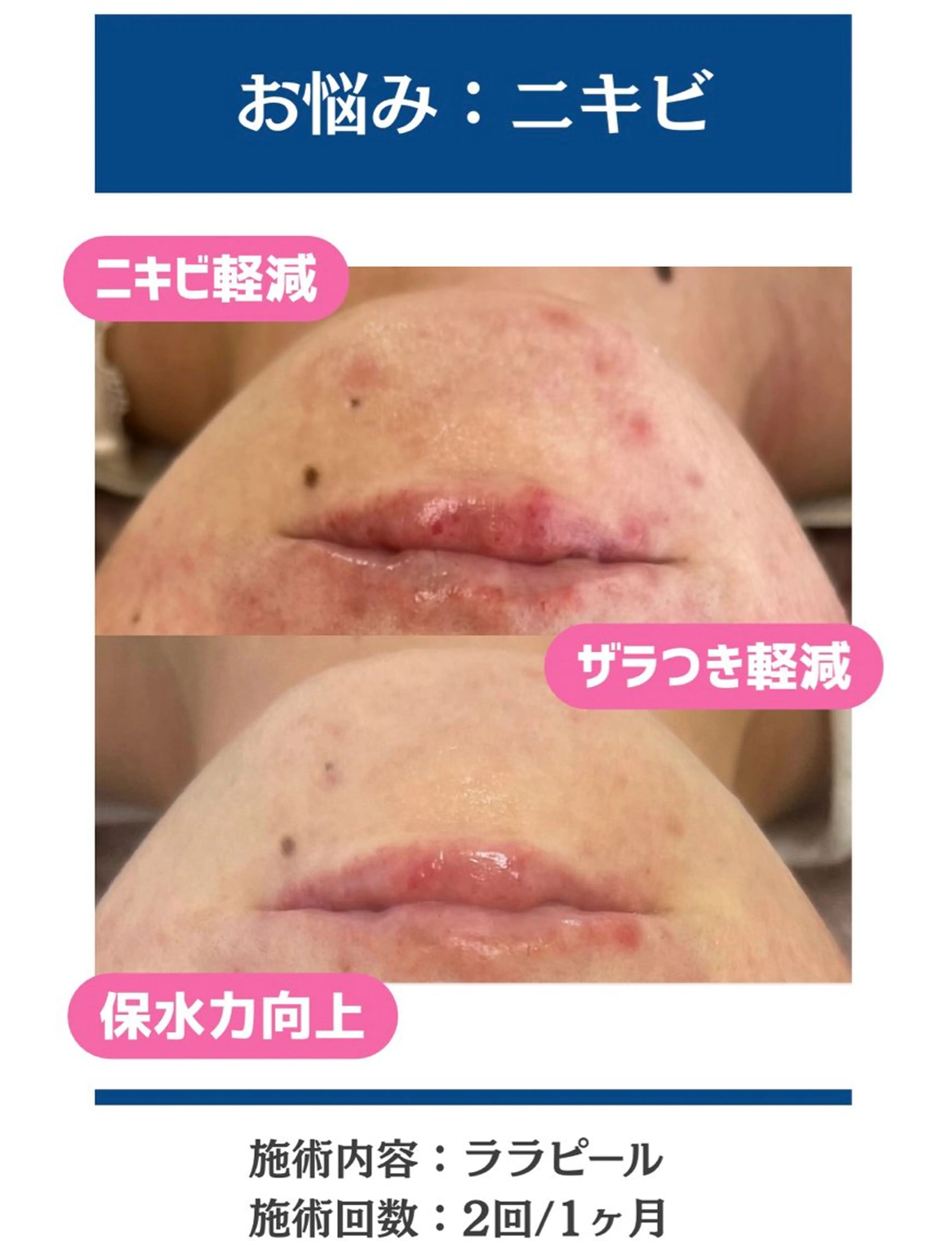 毛穴レス美肌へ🌿 看護師Abe🌼のエステ・リラクイメージ