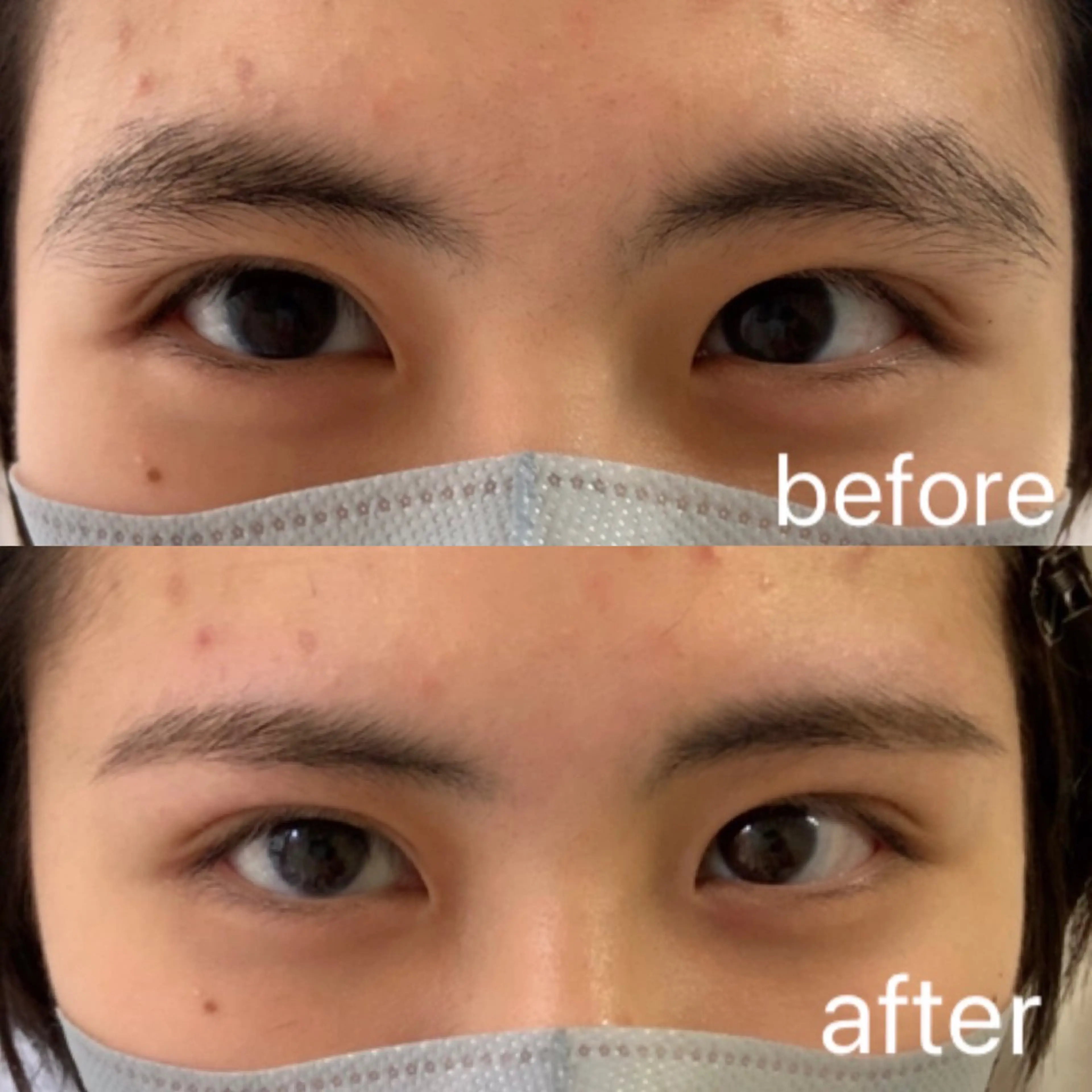 アイブロウ 眉毛ワックス脱毛 ワックス脱毛 emu所属・渡辺 かなみのエステ・リラクイメージ