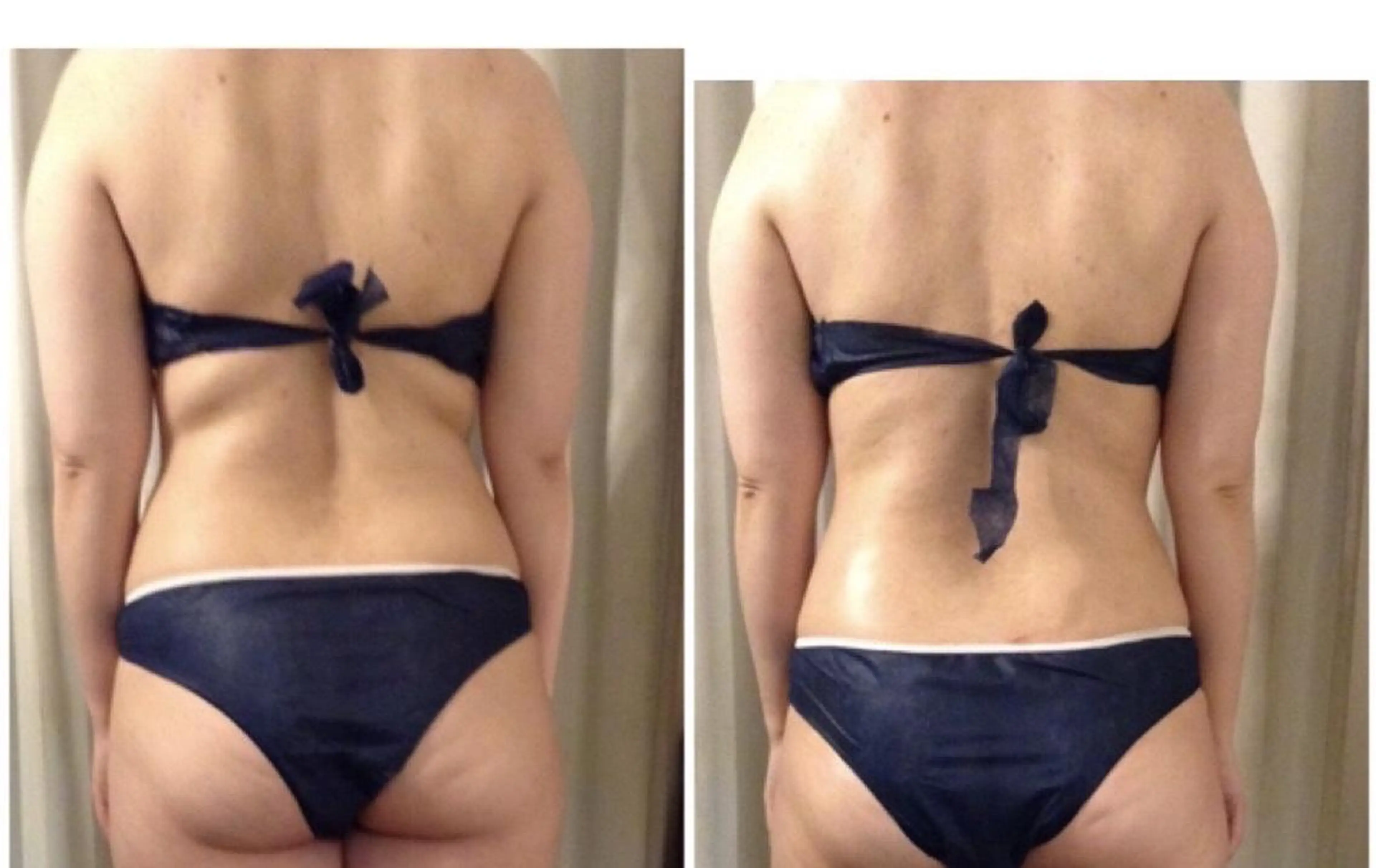 エステ Re, Luxのエステ・リラクイメージ