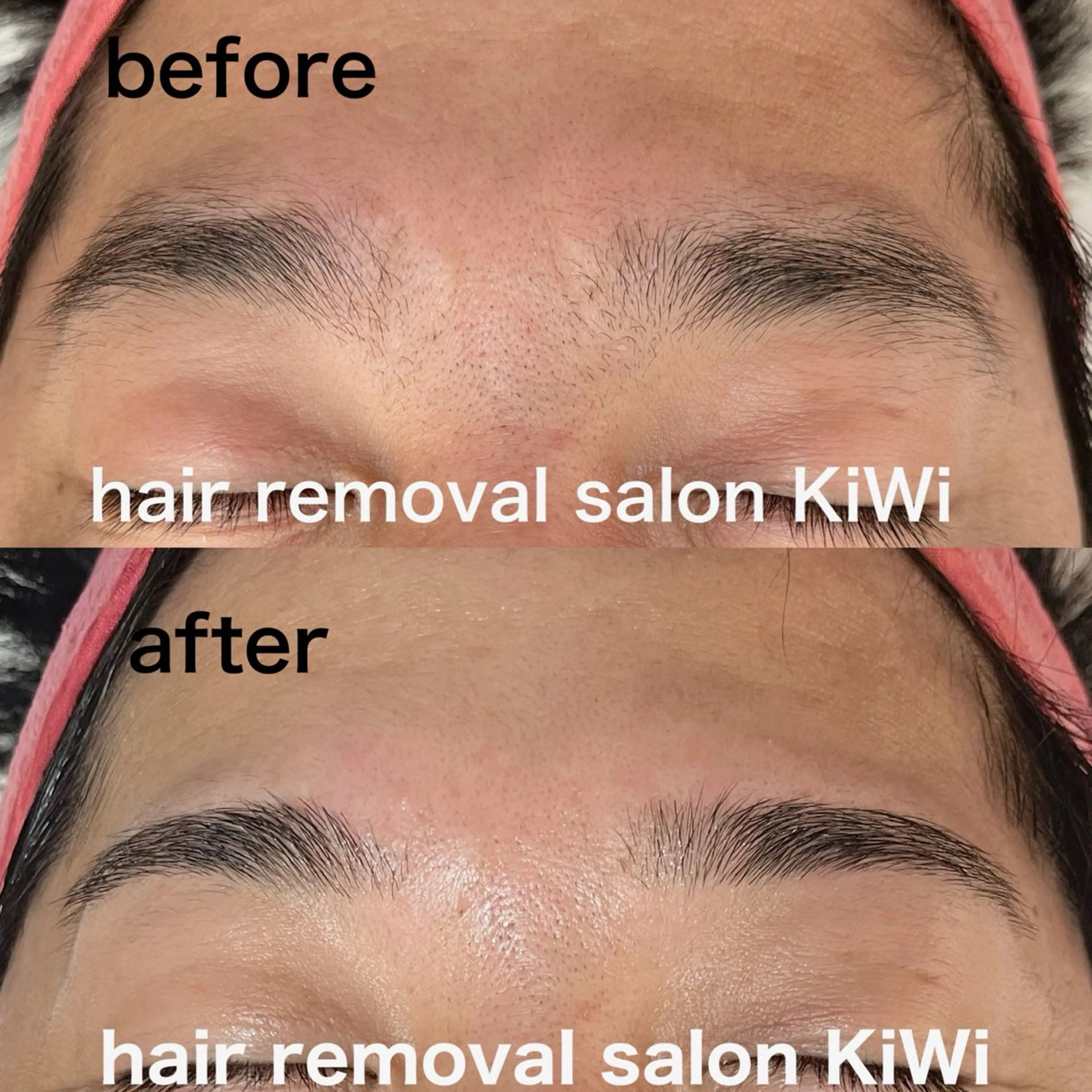 アイブロウ 脱毛サロン KiWiのエステ・リラクイメージ