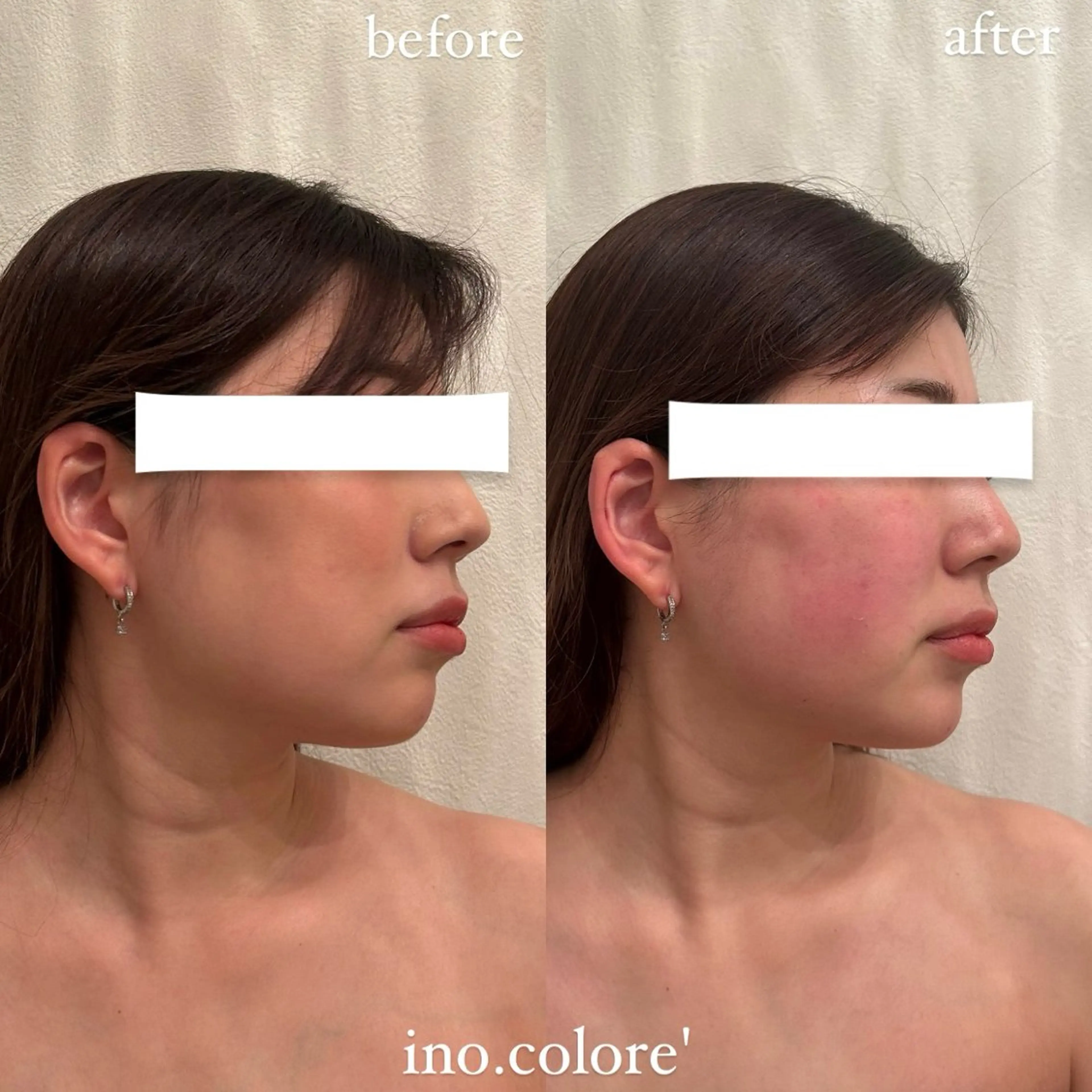 エステ リラク エステサロンino.colore'所属・小顔サロン ino.coloreのエステ・リラクイメージ