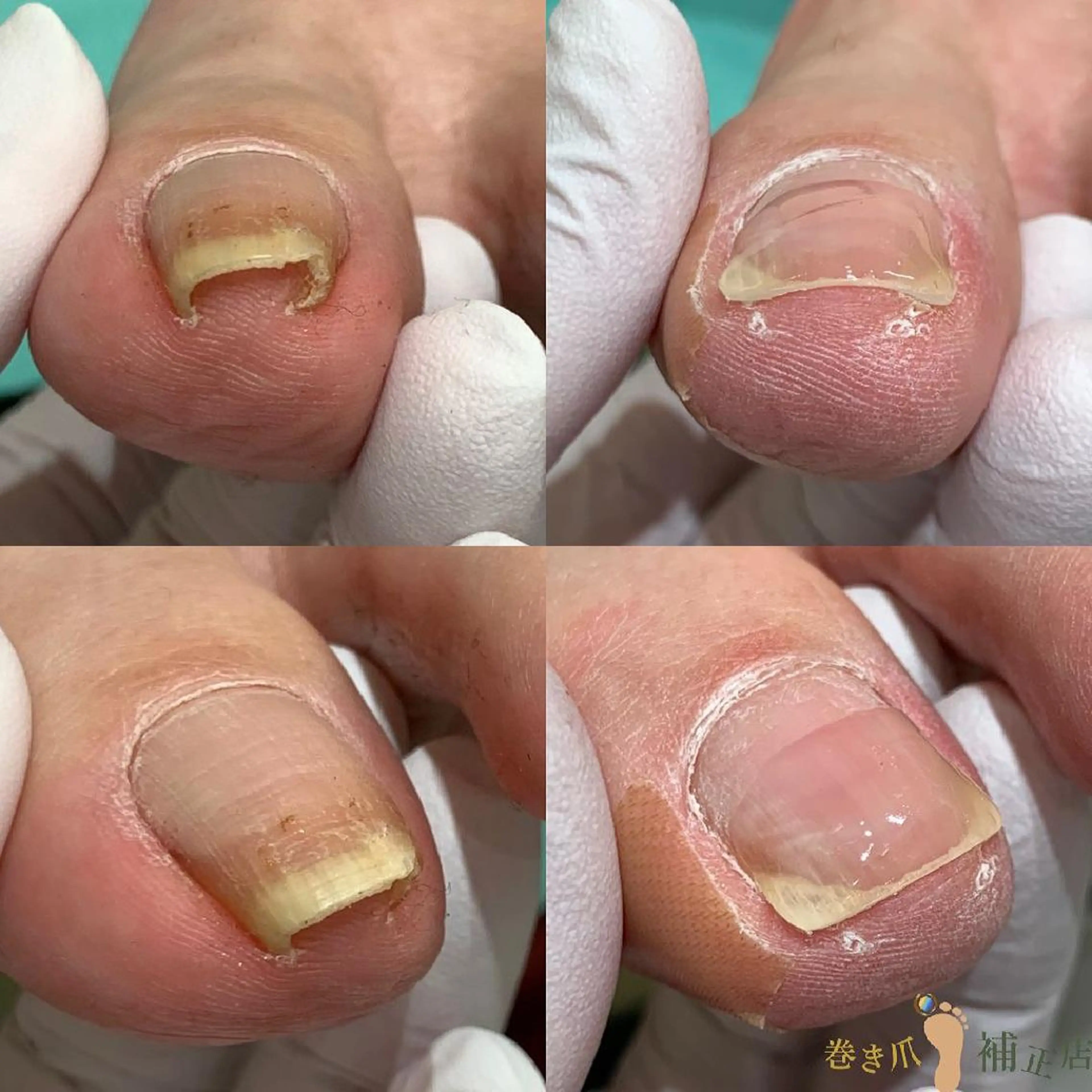 ネイル 東京巻き爪アカデミー所属・東京巻き爪 アカデミーのエステ・リラクイメージ