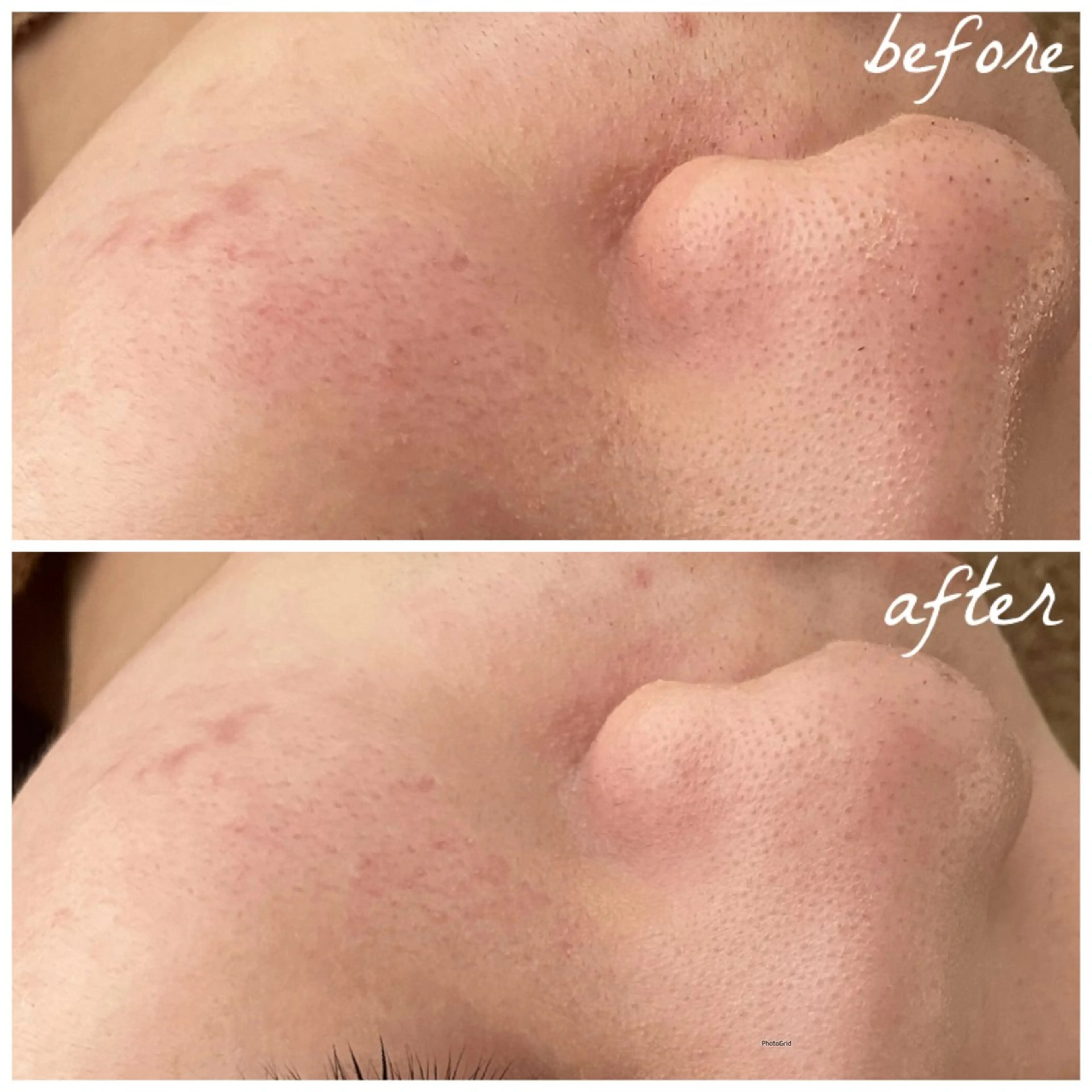 メンズ エステ メナード岐阜茜部 杉浦のエステ・リラクイメージ