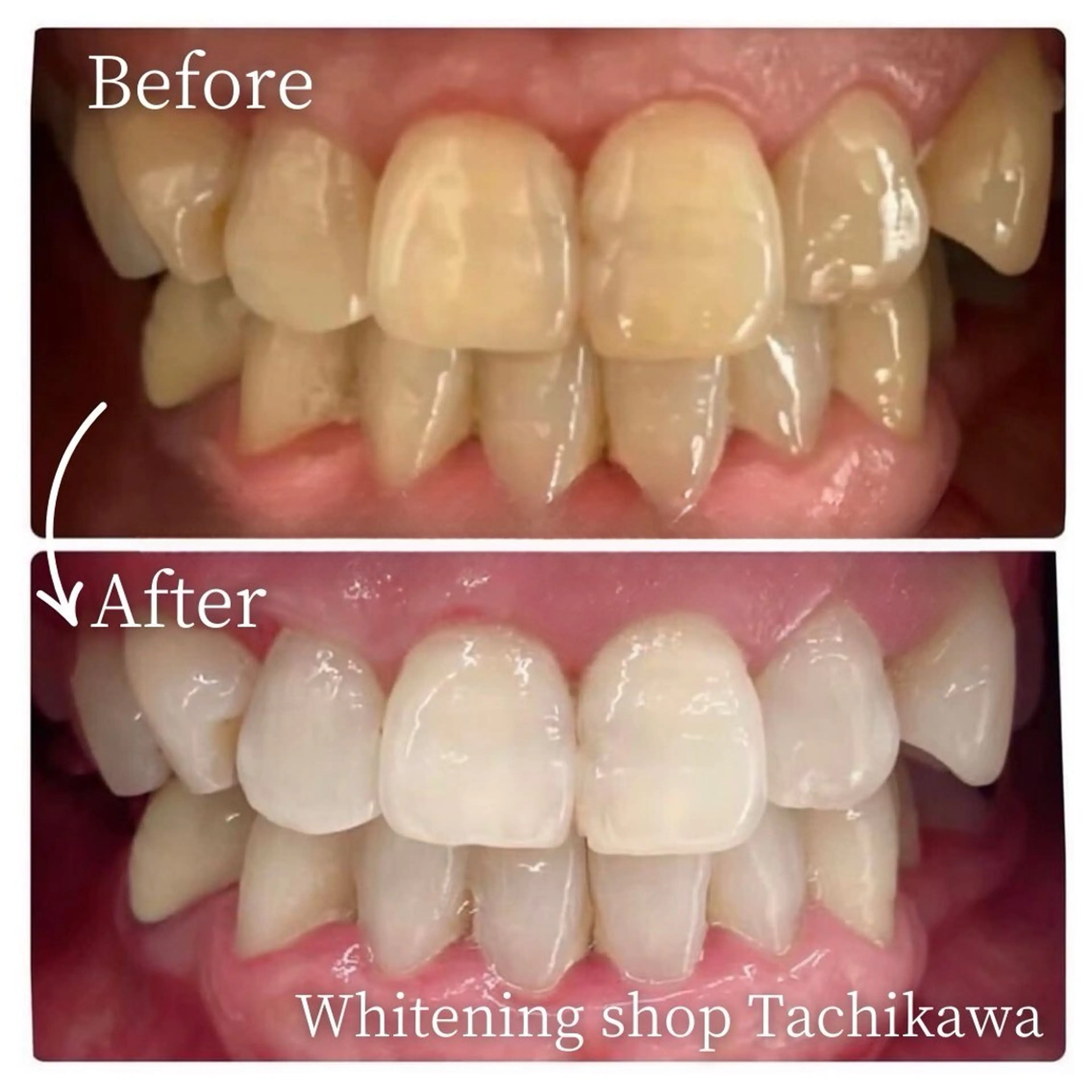 セルフ　ホワイト ニングショップ立川のその他イメージ