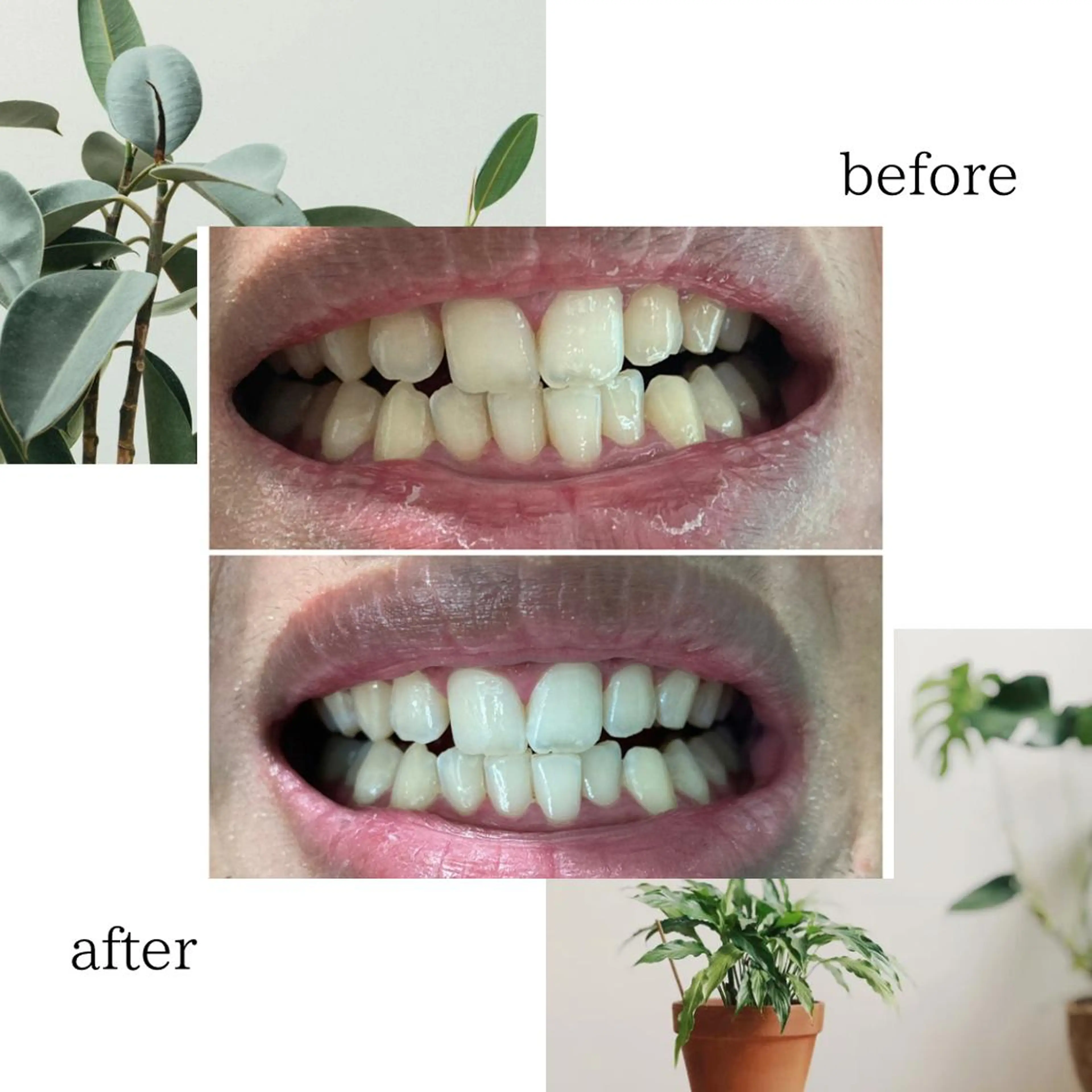 その他 脱毛専門サロンELIXIR（ｴﾘｸｻｰ）所属・脱毛&ホワイトニング ELIXIR×ULTのエステ・リラクイメージ