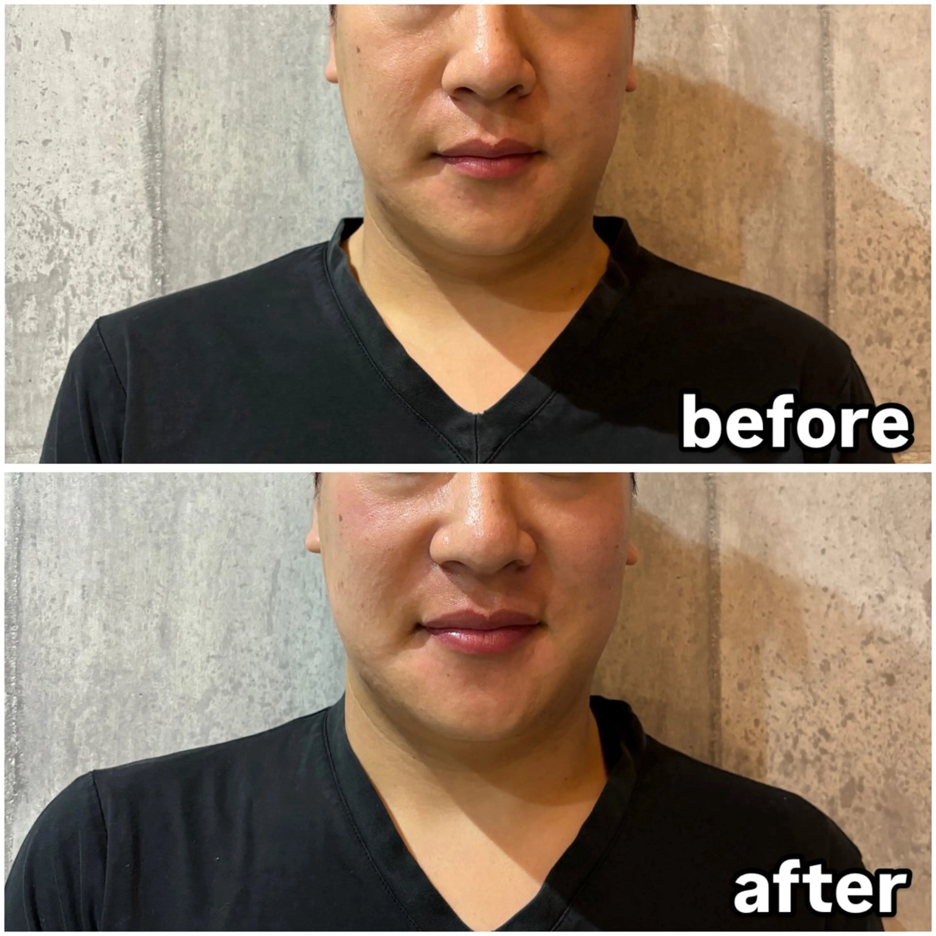 メンズ Men's Nail Vitip所属・sekiyama junnaのエステ・リラクイメージ