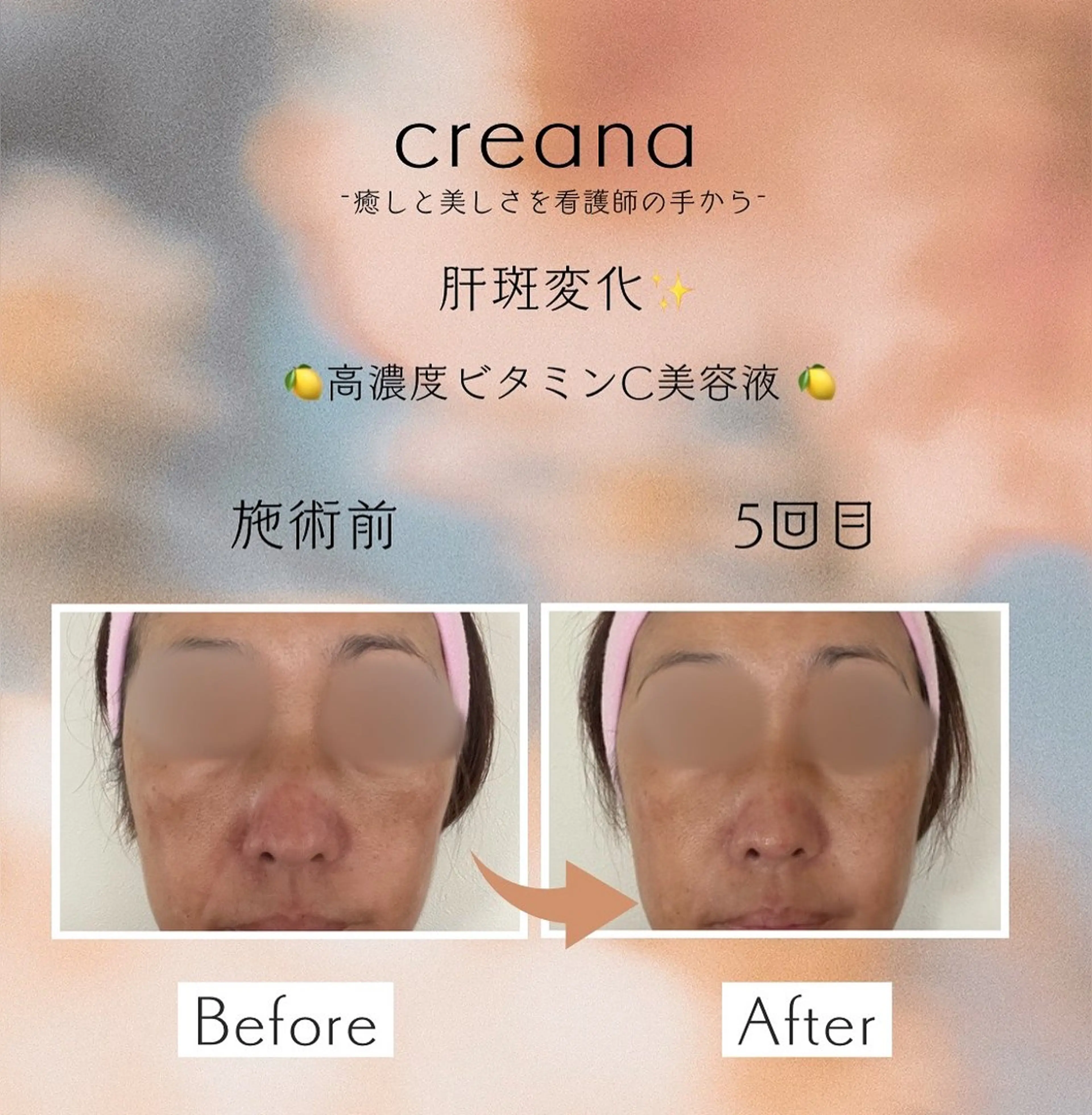 韓国美容🇰🇷 creana🌿のエステ・リラクイメージ