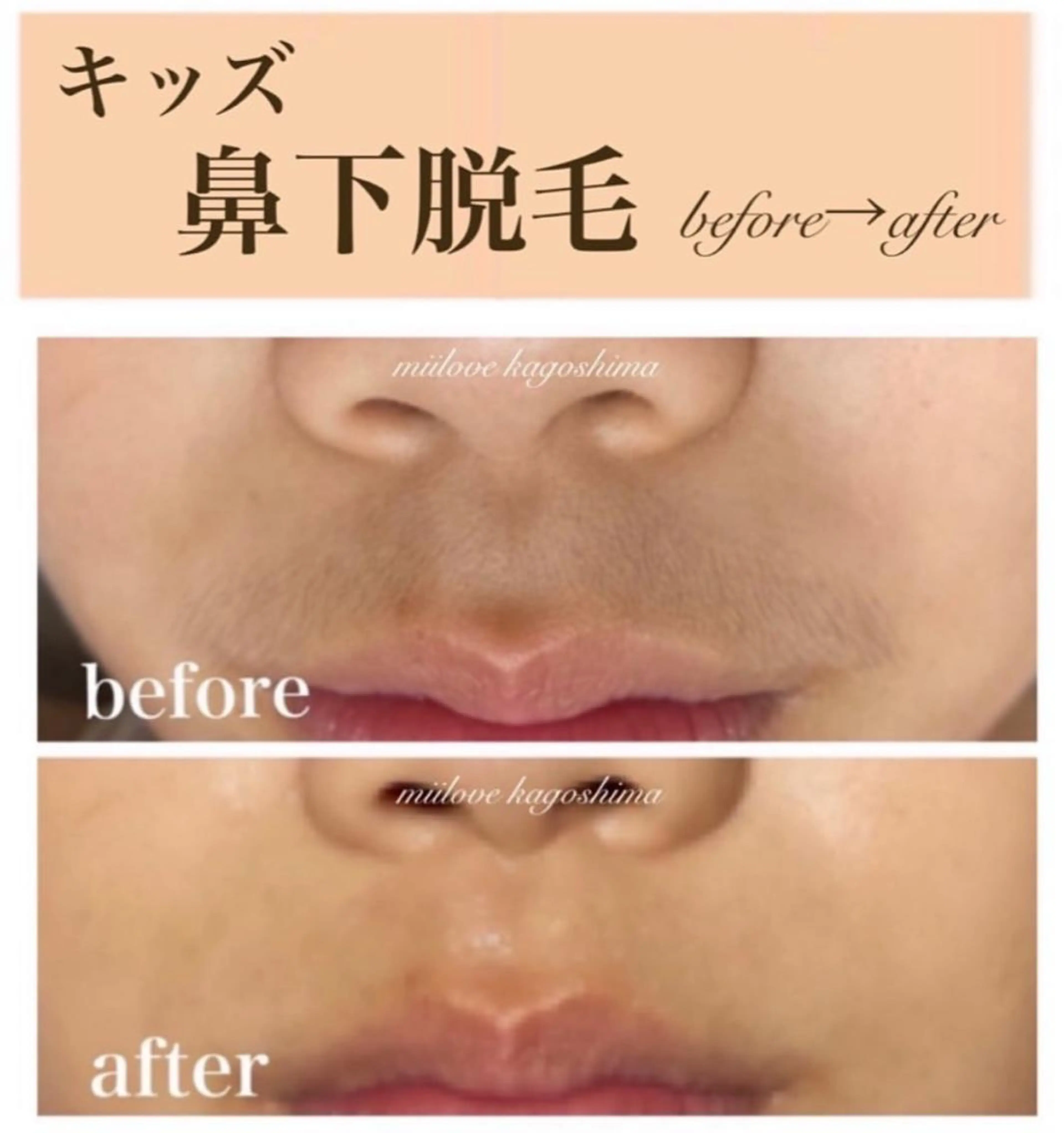 キッズ miilove 鹿児島店のエステ・リラクイメージ