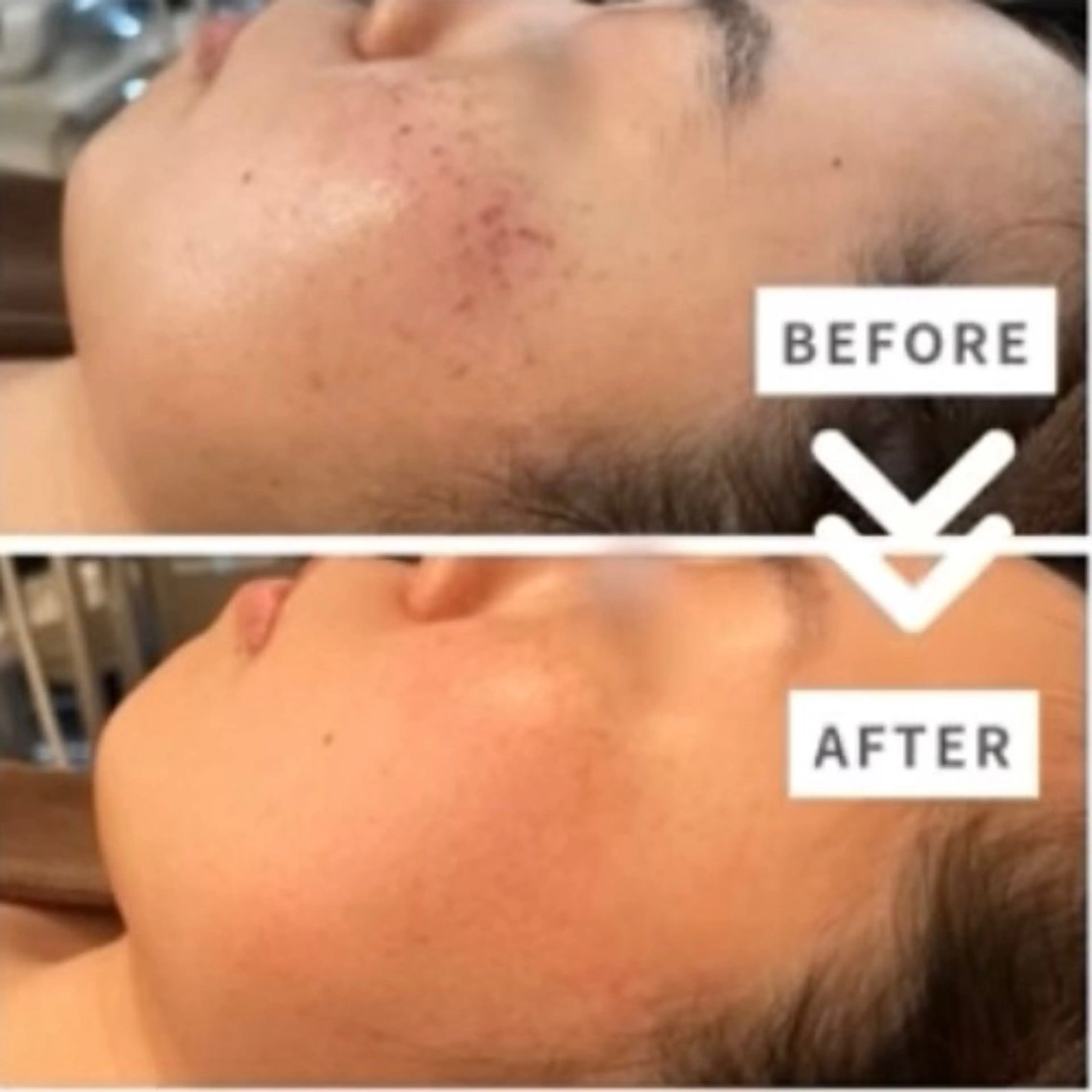 Rifuro 勝田台エステ所属・Rifuro勝田台 ララピール・毛穴洗浄のエステ・リラクイメージ