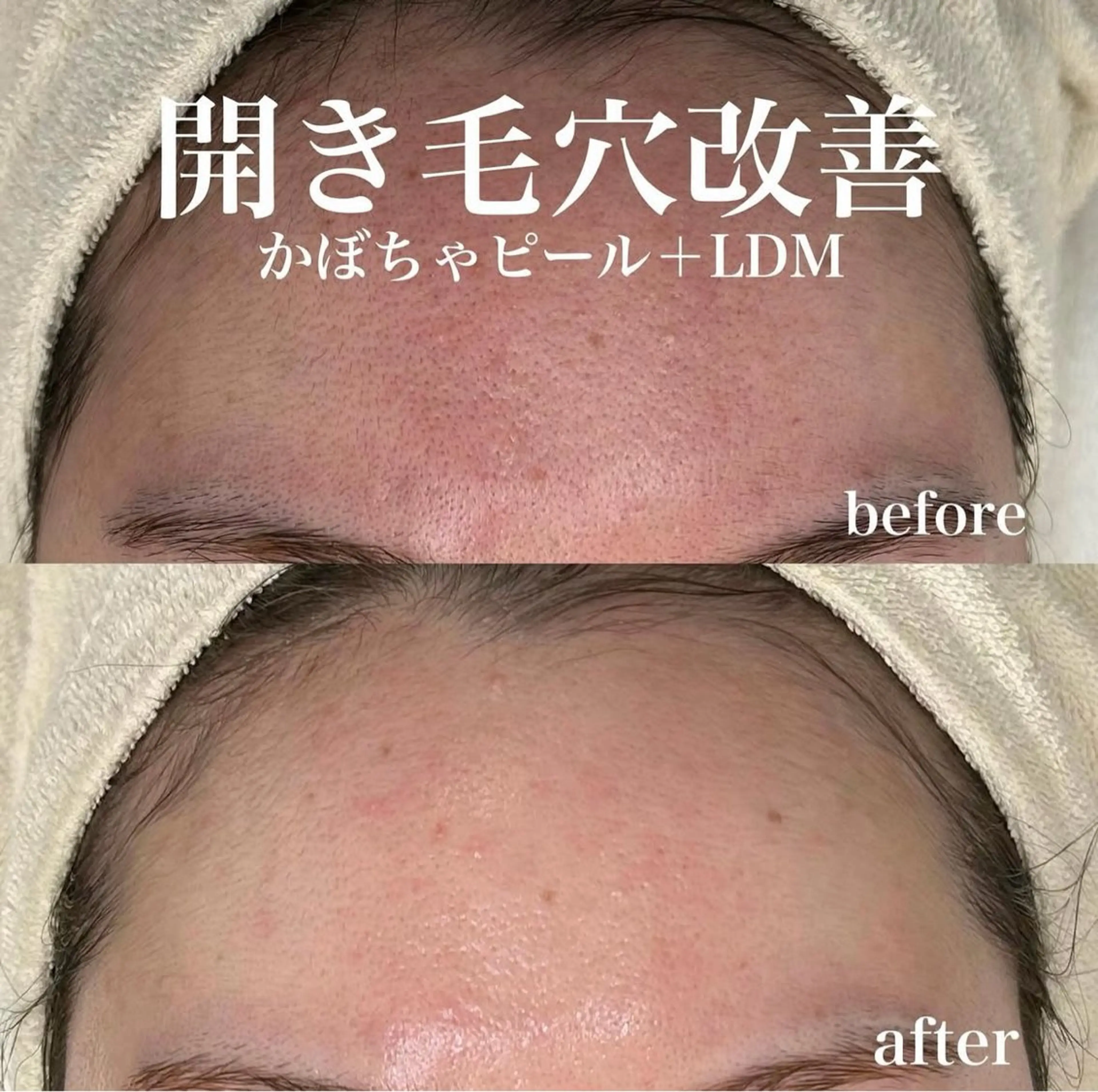 韓国肌管理&小顔 ＩＲＯＨＡのエステ・リラクイメージ