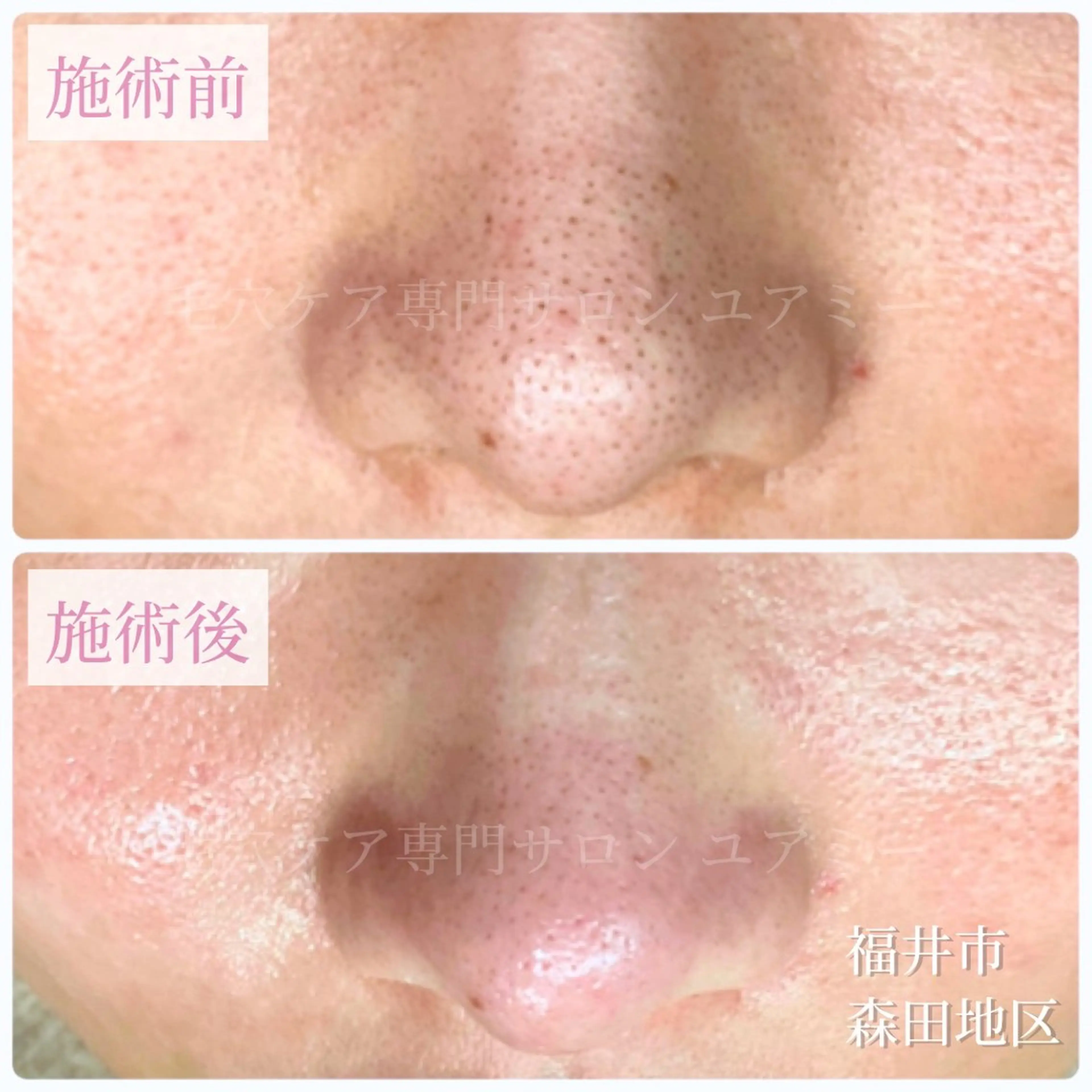 エステ リラク 毛穴肌質ケアサロン Yourmeユアミーのエステ・リラクイメージ