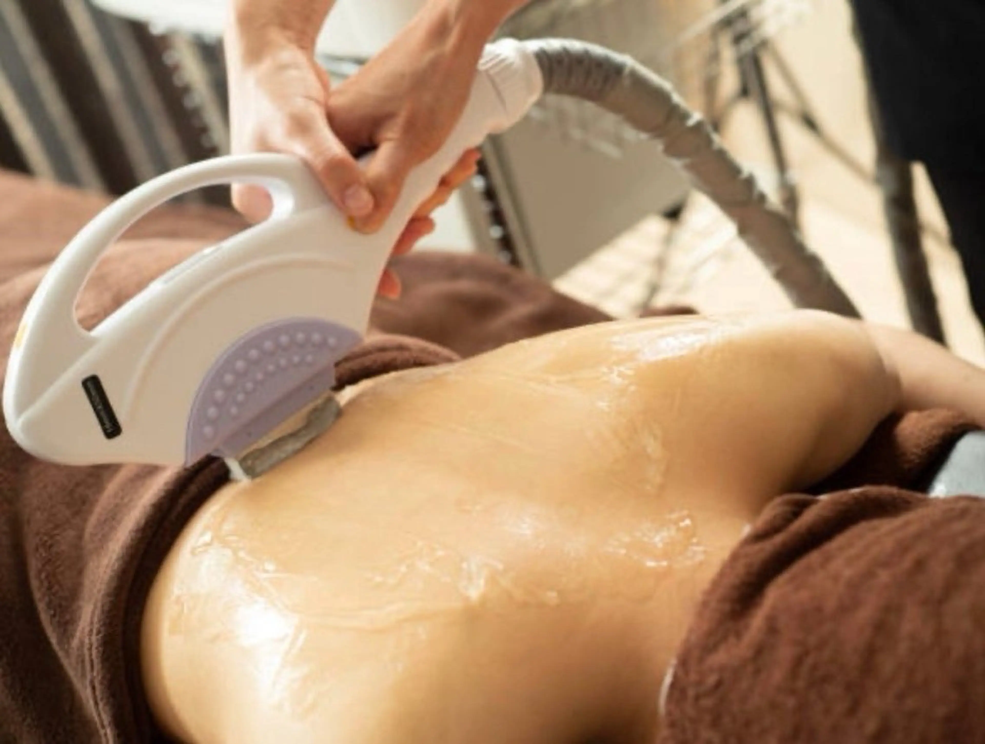 ツルツル楽ちん！☆初回限定☆全身脱毛　　　　　　　　　【顔+VIO付き】夏に向けて脱毛始めませんか？の写真