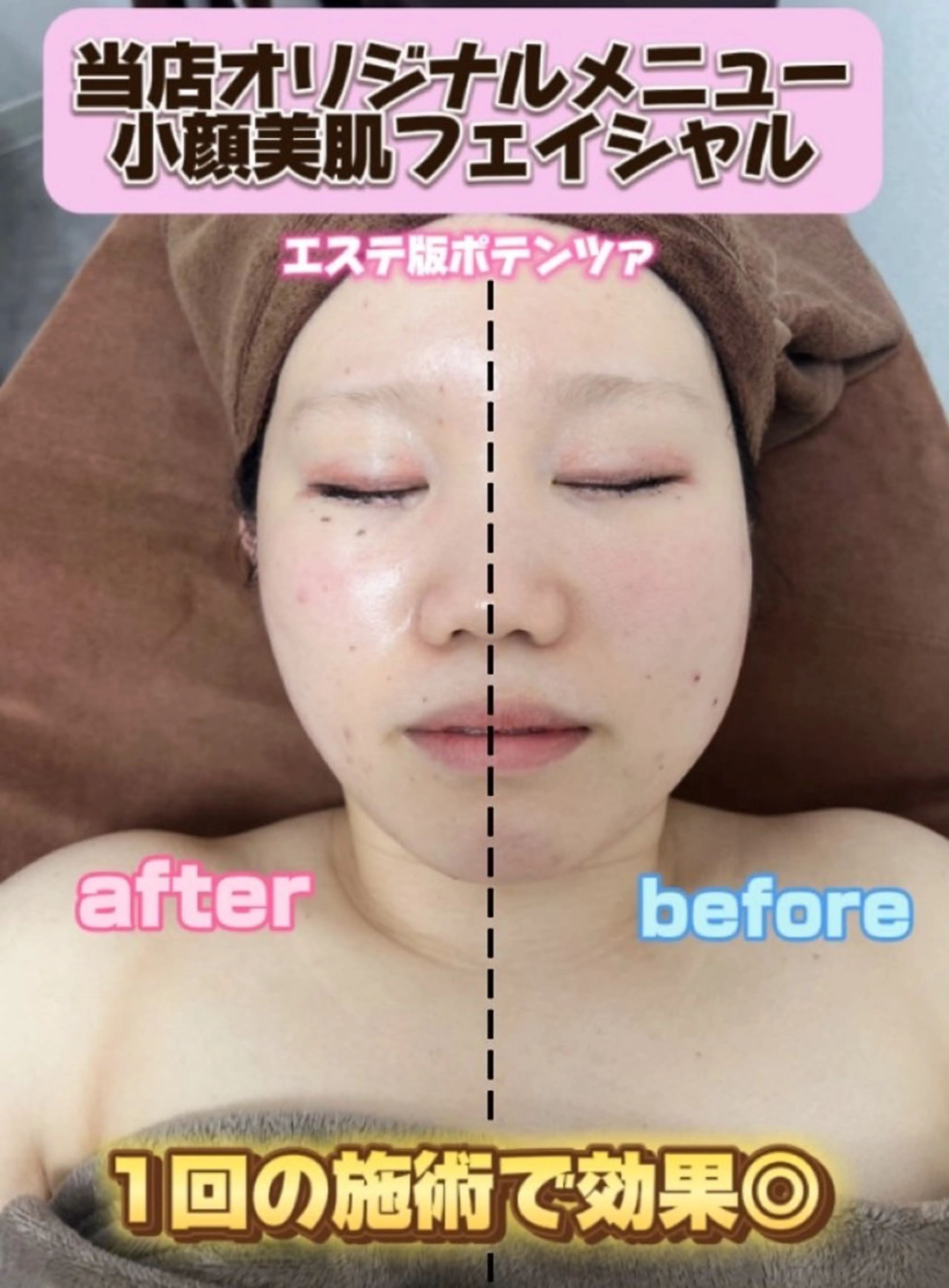 小顔美肌フェイシャル💆無料モニター(18歳以上29歳以下⚠️高校生不可)※初回のみ※お一人様1回のみの写真
