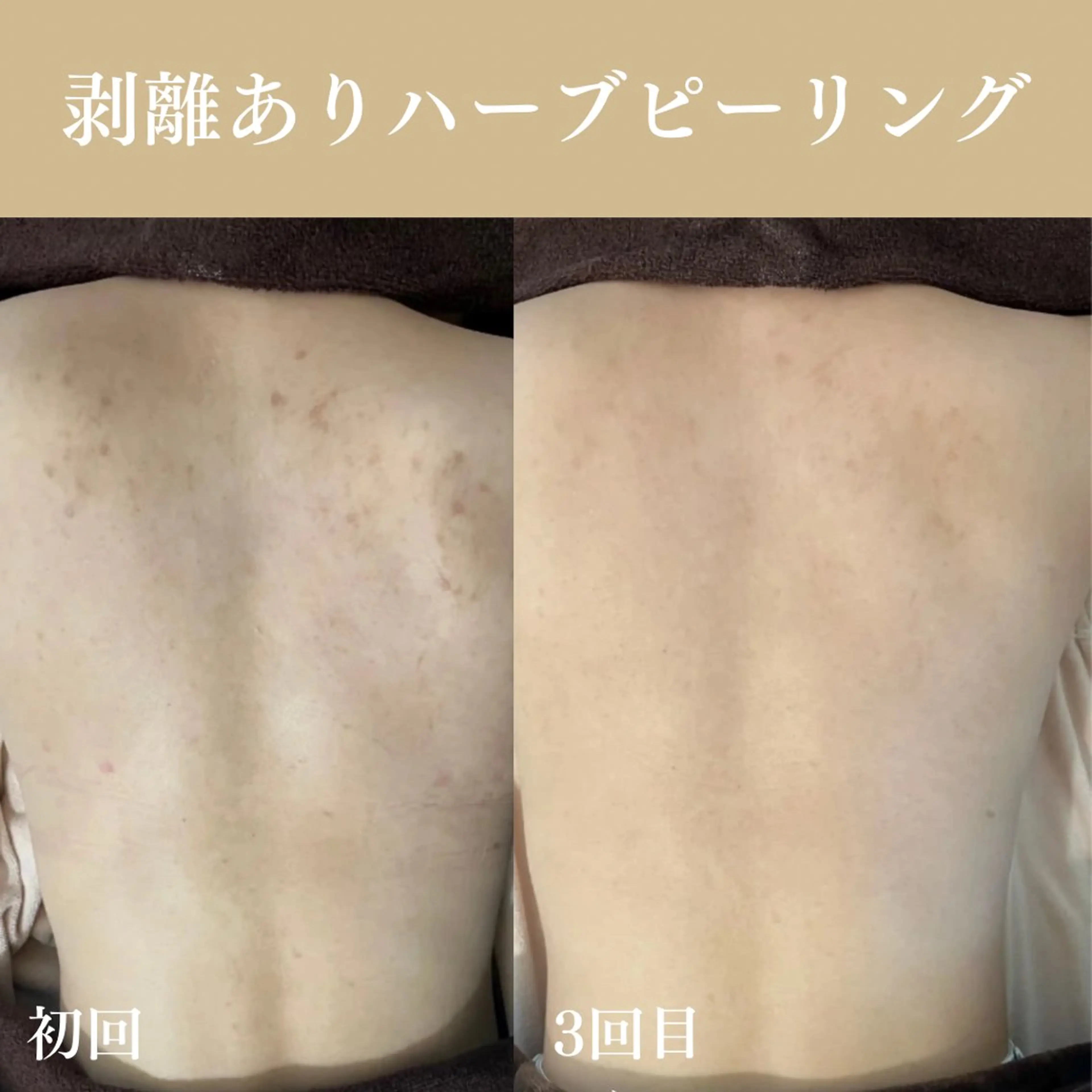 Oncebell. Bodymake&beautysalon所属・Oncebell. ワンベルのエステ・リラクイメージ