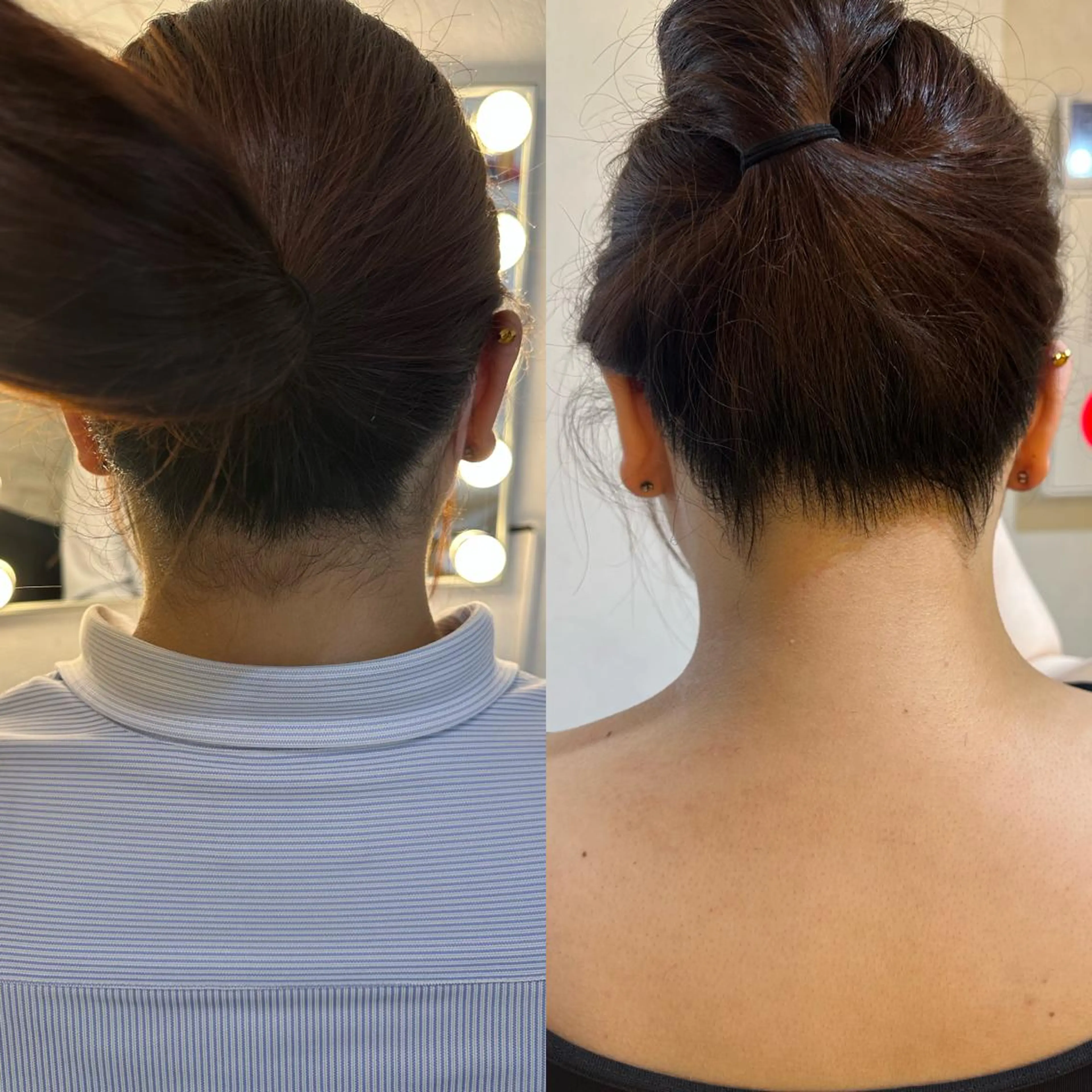 脱毛 うなじ脱毛/美肌脱毛 LABELのエステ・リラクイメージ