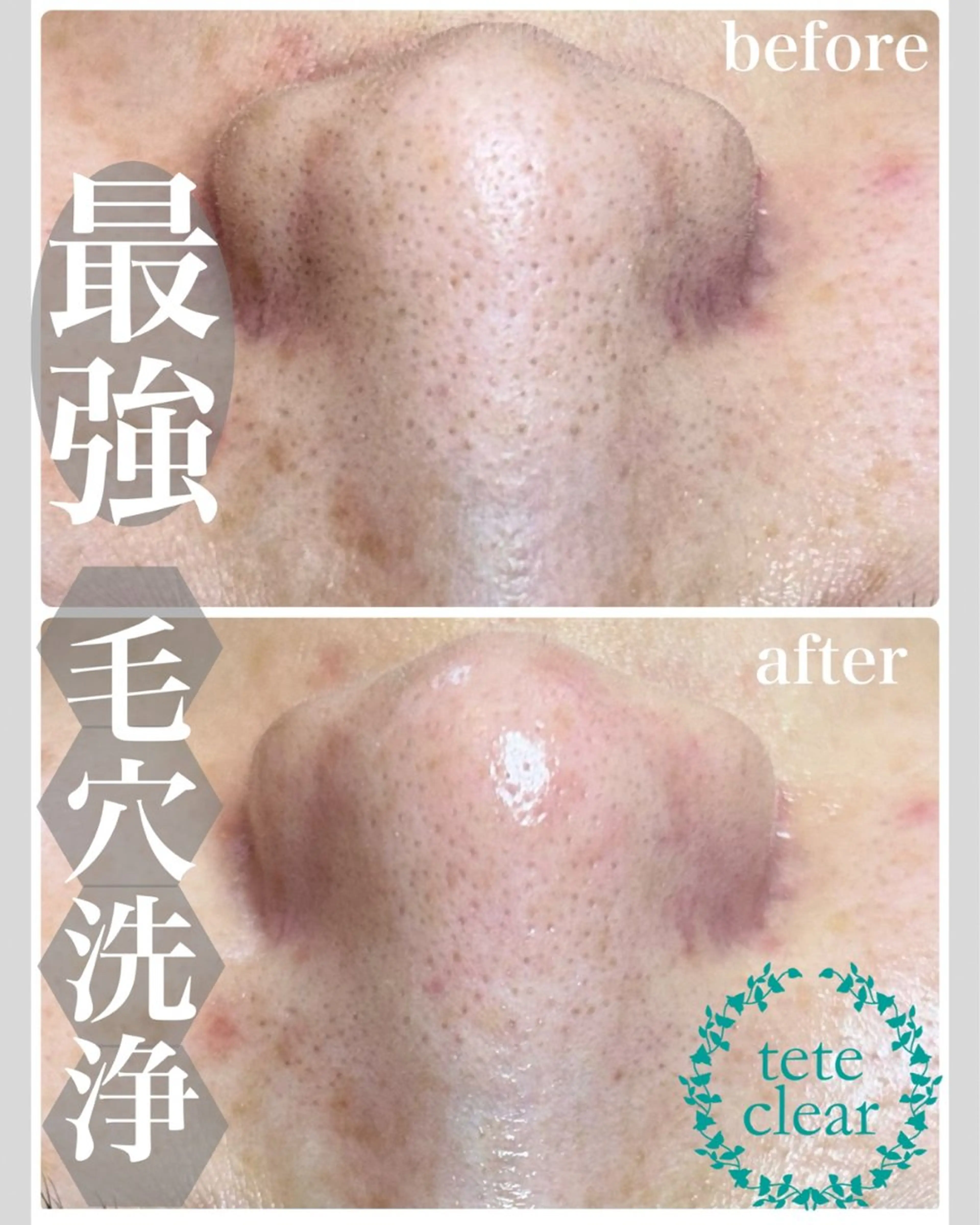 エステ Soin＋ みきのエステ・リラクイメージ