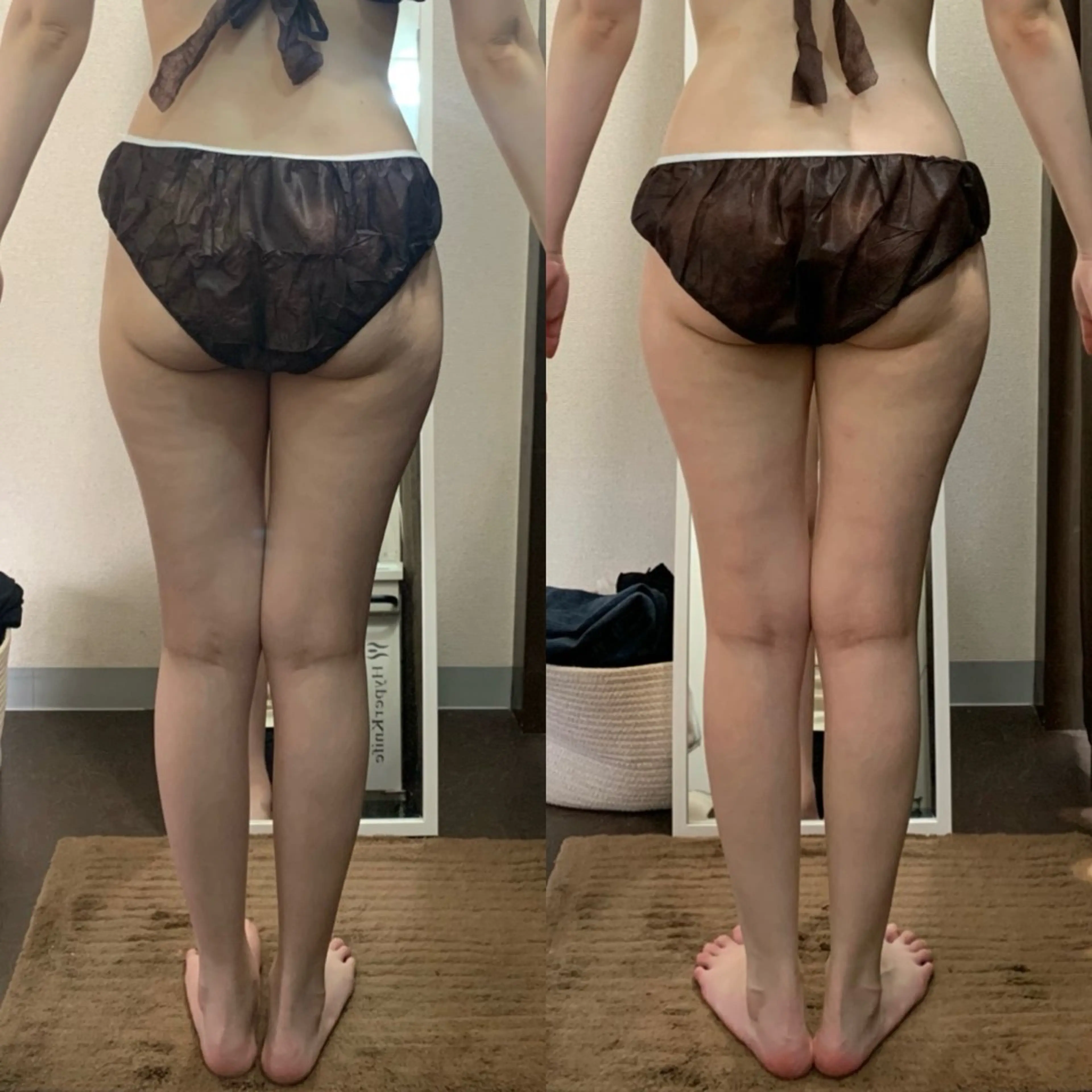 ハイパーナイフ専門店　Salon de COCO所属・Salon de COCOのエステ・リラクイメージ