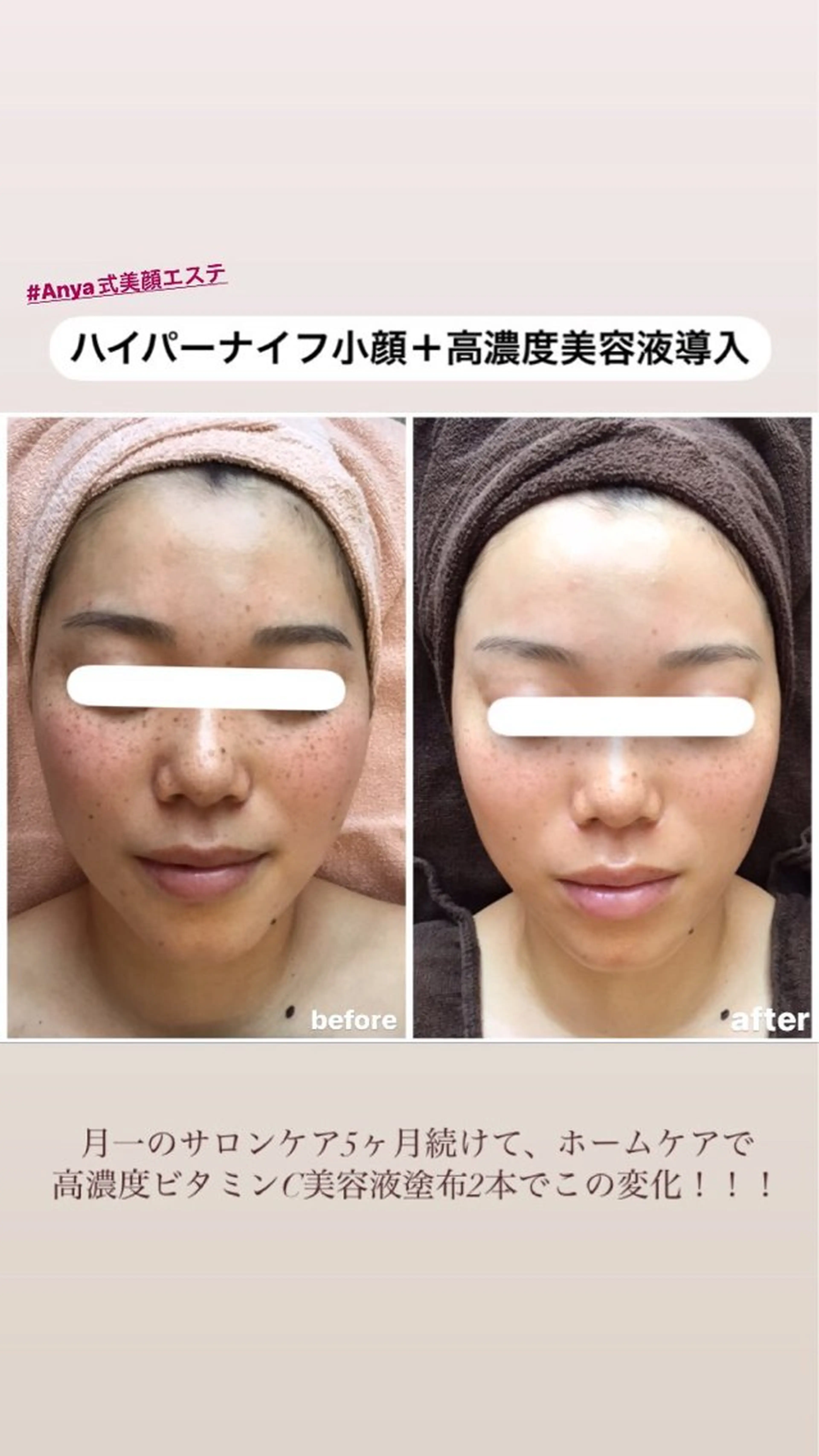 エステ Anya Beautyのエステ・リラクイメージ