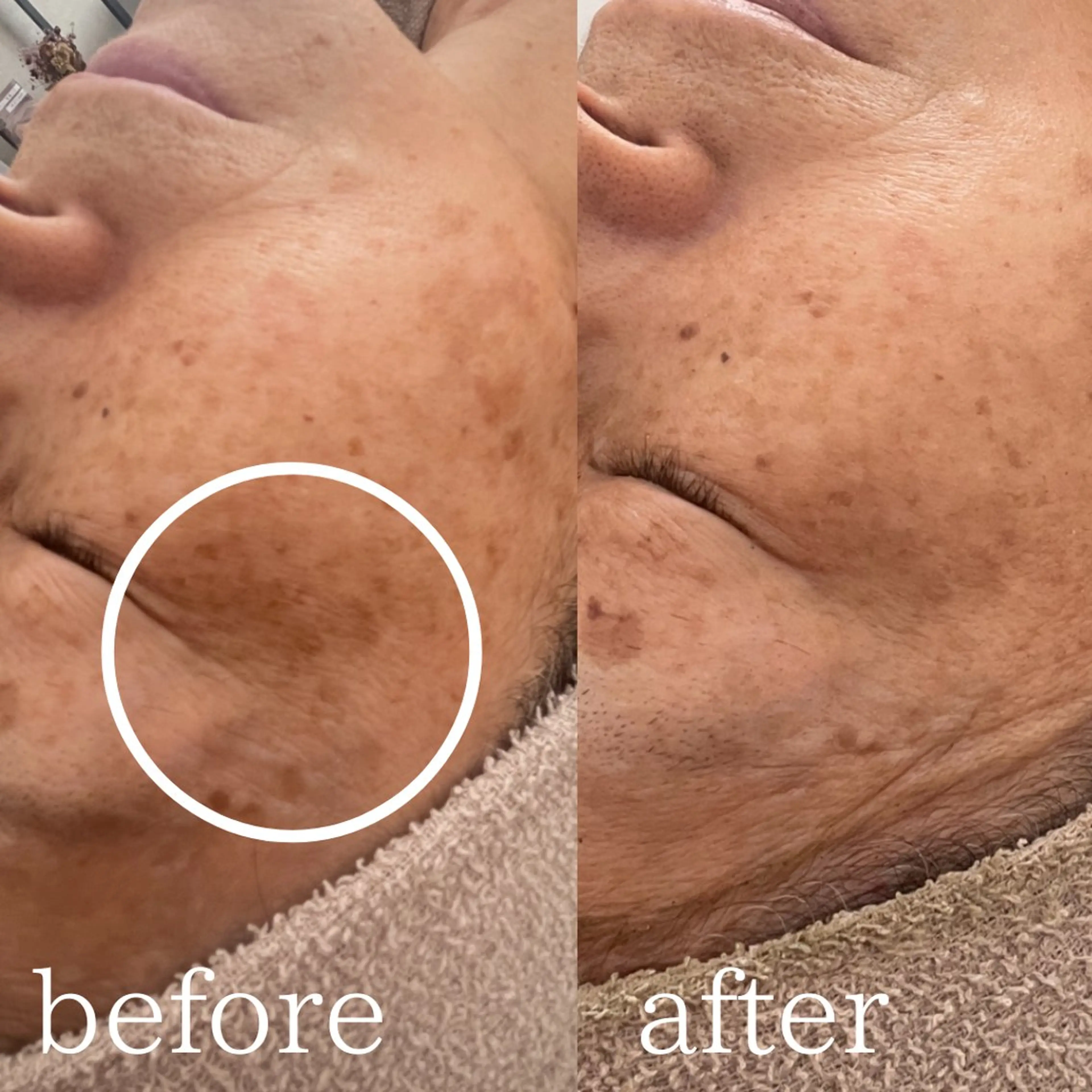 Beauty SalonReeleのエステ・リラクイメージ