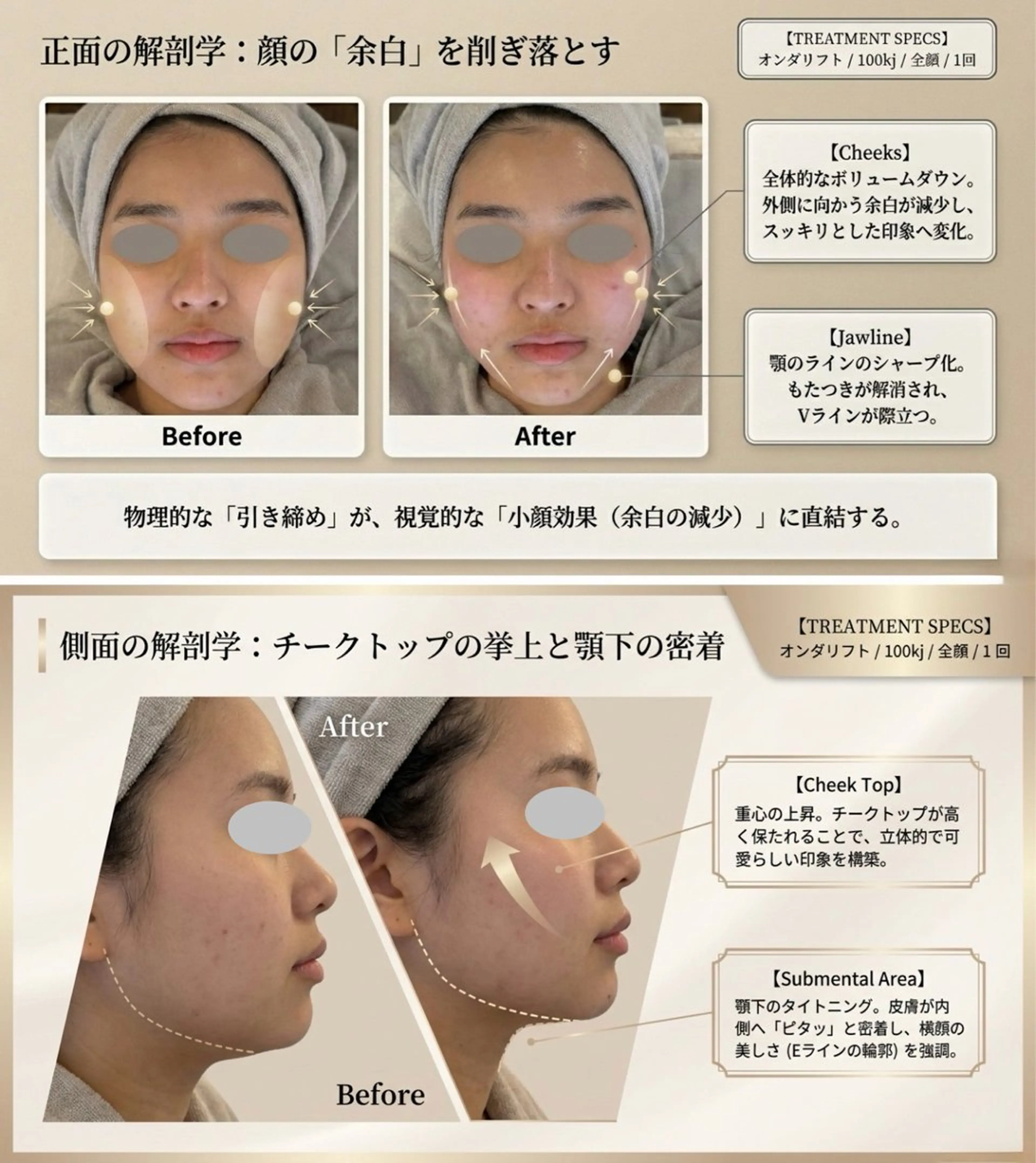 エステ 東京オンダリフト・よもぎ蒸し専門　恵比寿店所属・恵比寿 オンダリフト 小顔ケアのエステ・リラクイメージ