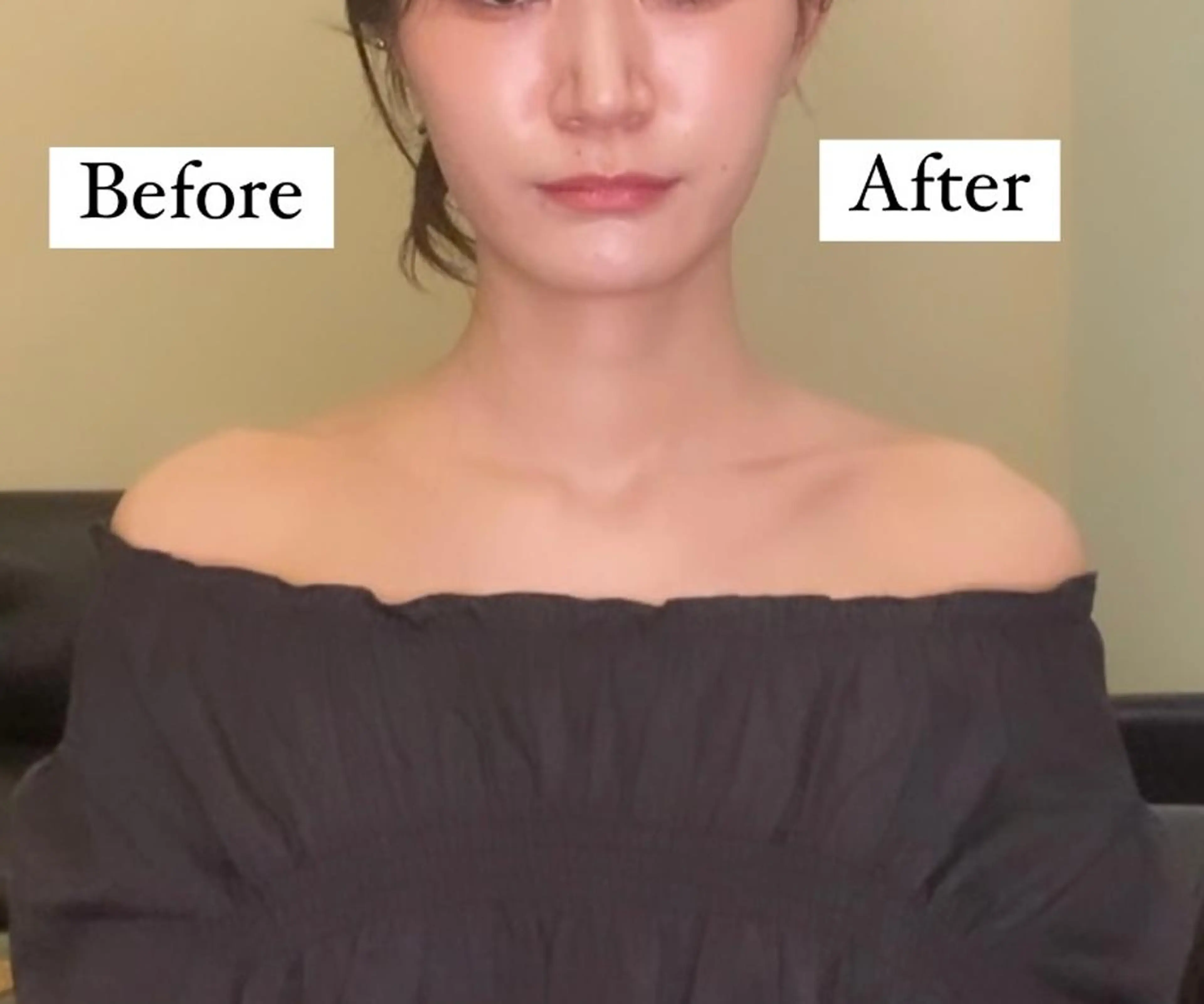 フェイスライン+上半身(肩・首・肩甲骨・背中) スッキリコースの写真