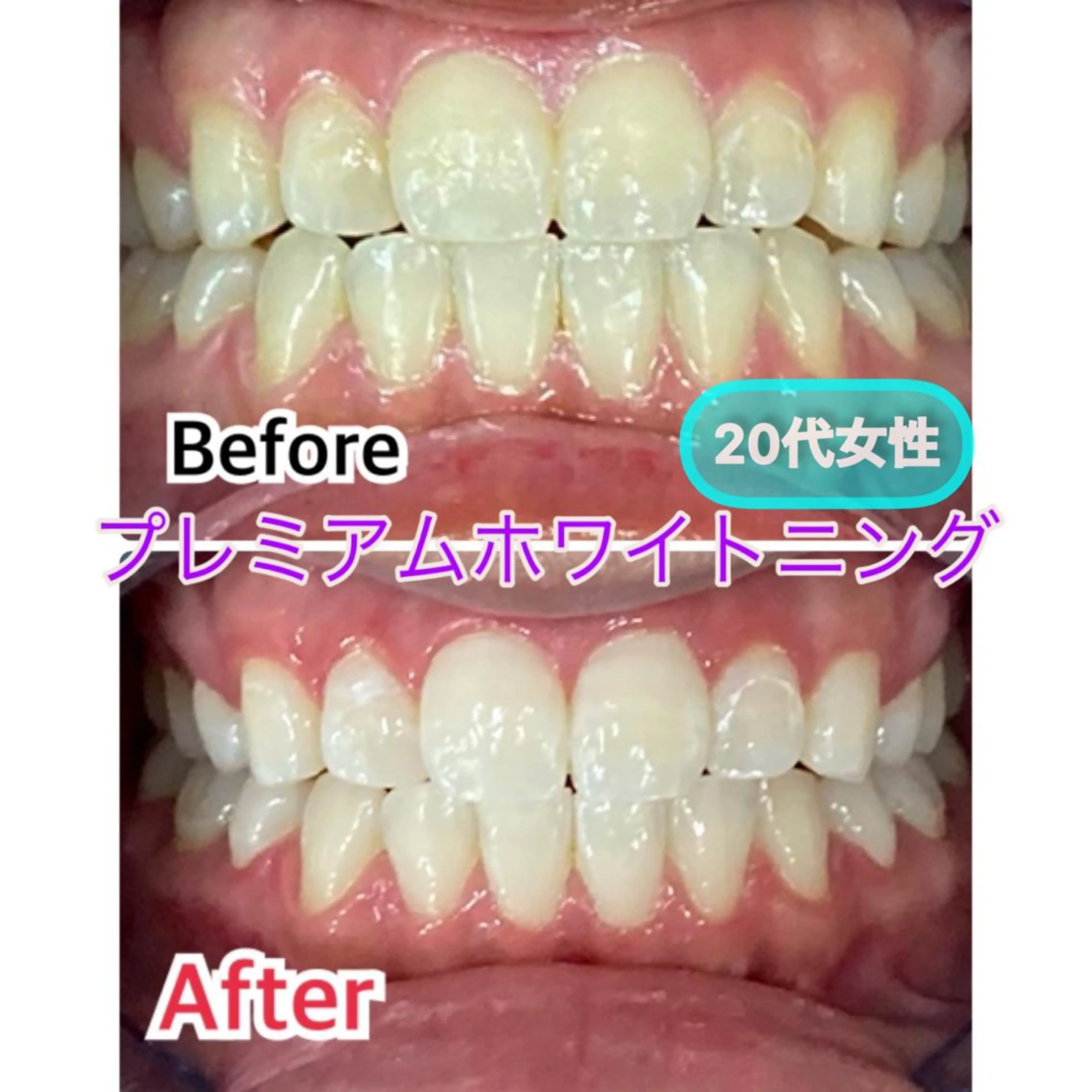 プラチナムビューティー柏所属・【歯科提携】柏ホワイ トニングスタイルのその他イメージ