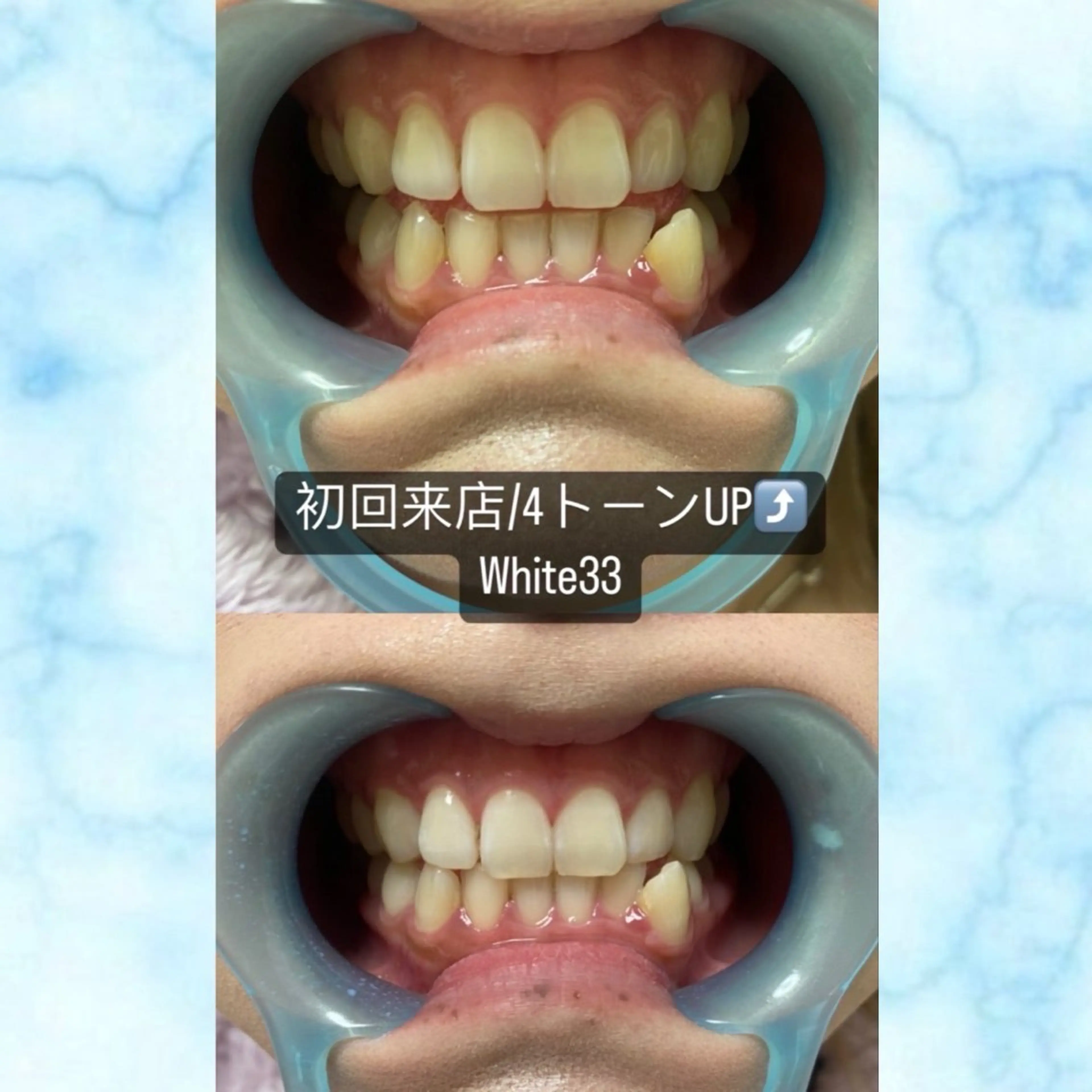 セルフホワイトニング　アデル所属・戸嶋 菫のエステ・リラクイメージ