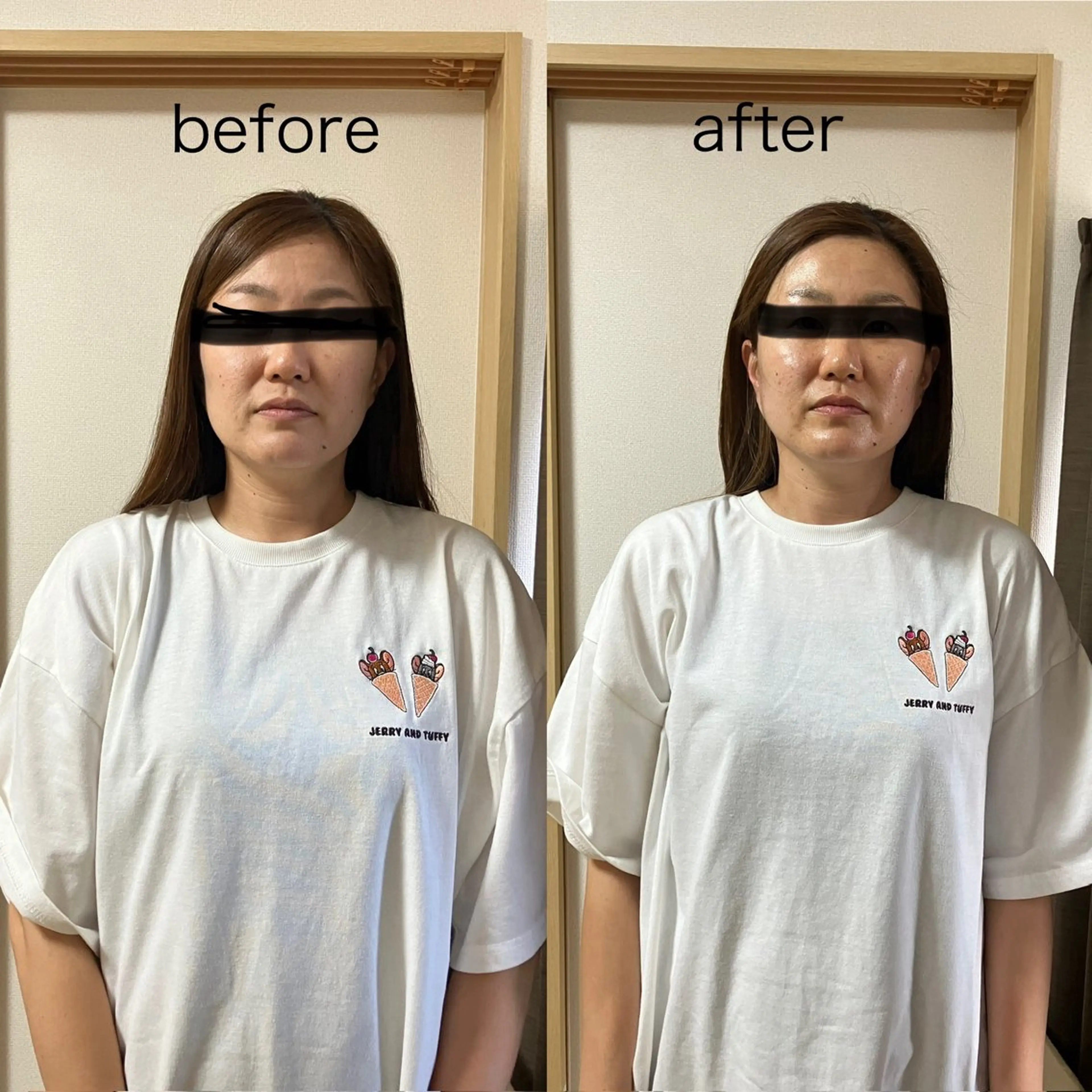 フェイシャルエステの写真